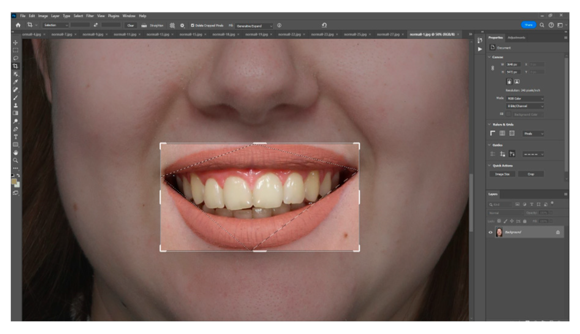 Dentistry 13 00380 g009