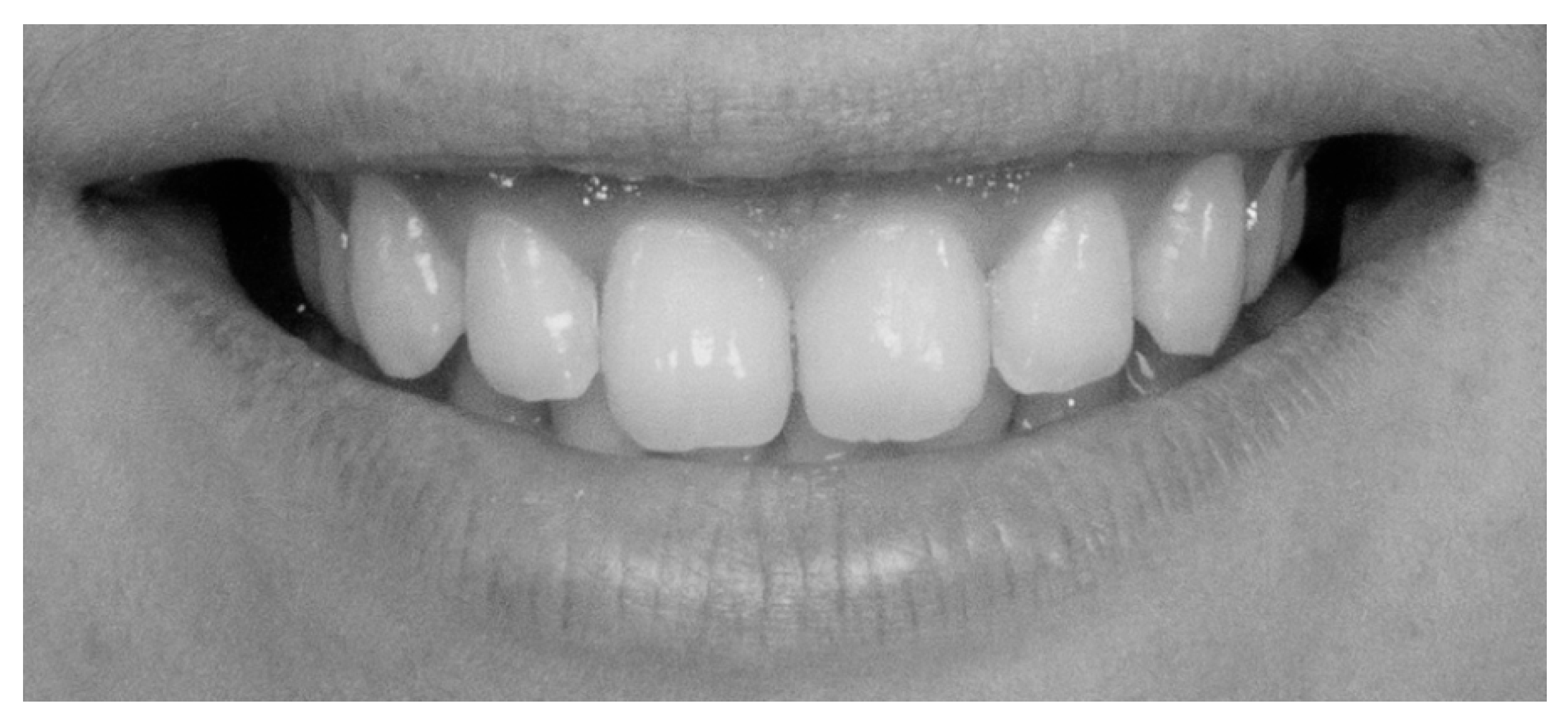 Dentistry 13 00380 g011