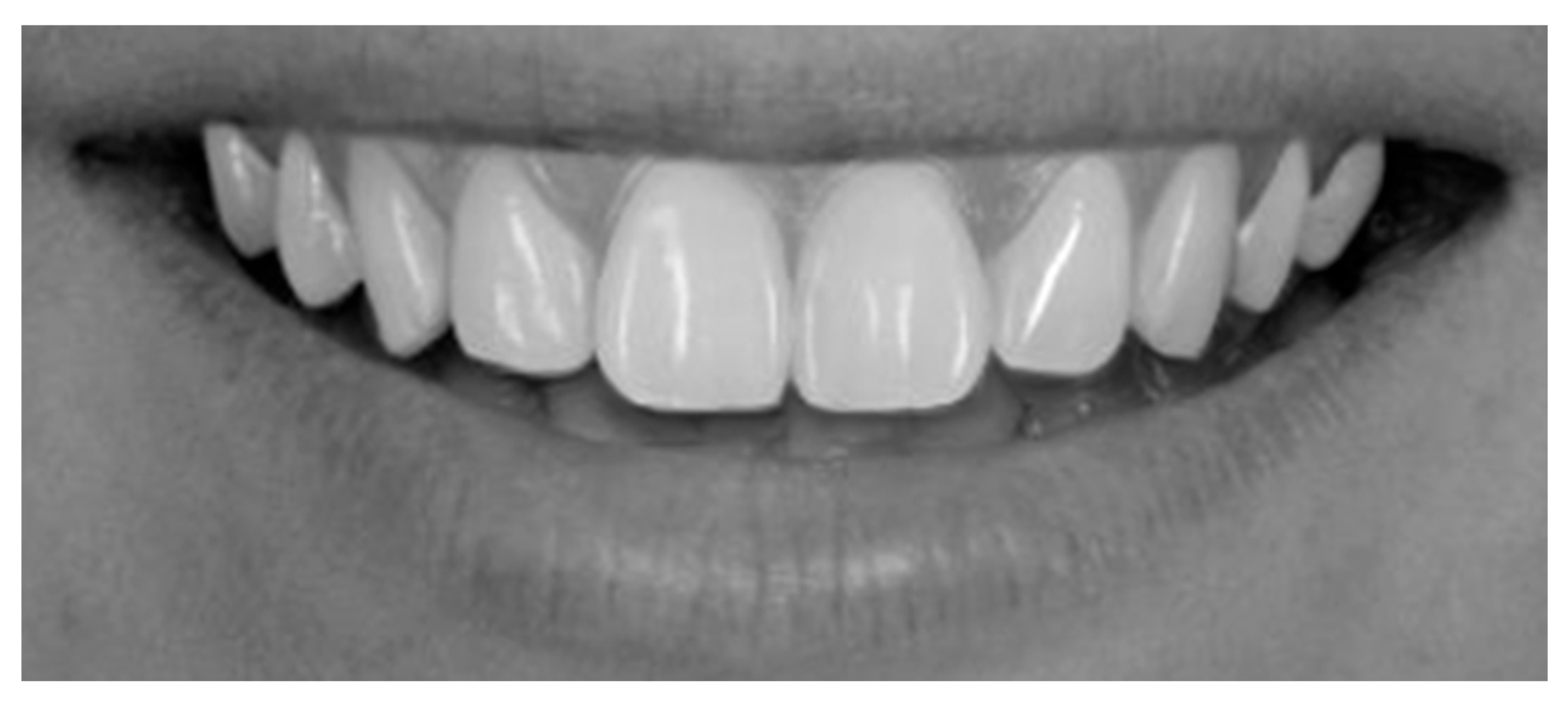 Dentistry 13 00380 g012