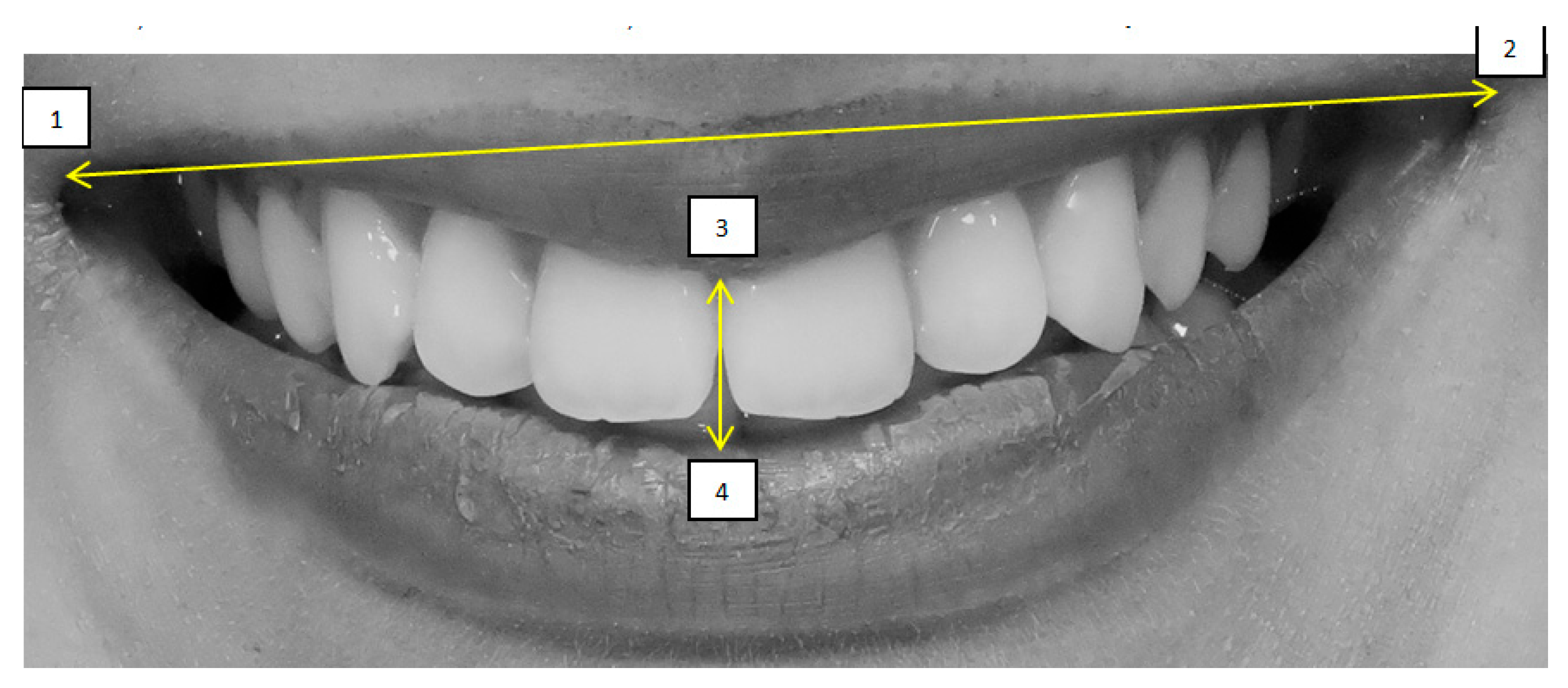 Dentistry 13 00380 g013