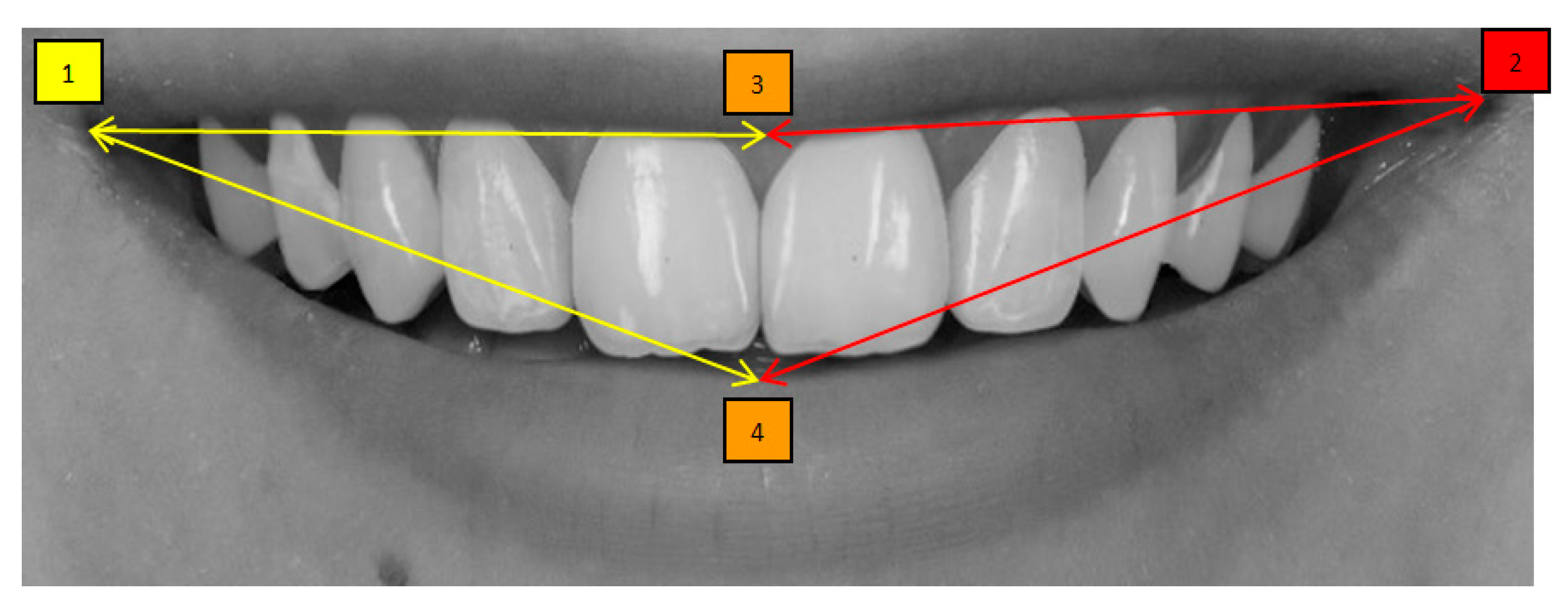 Dentistry 13 00380 g014