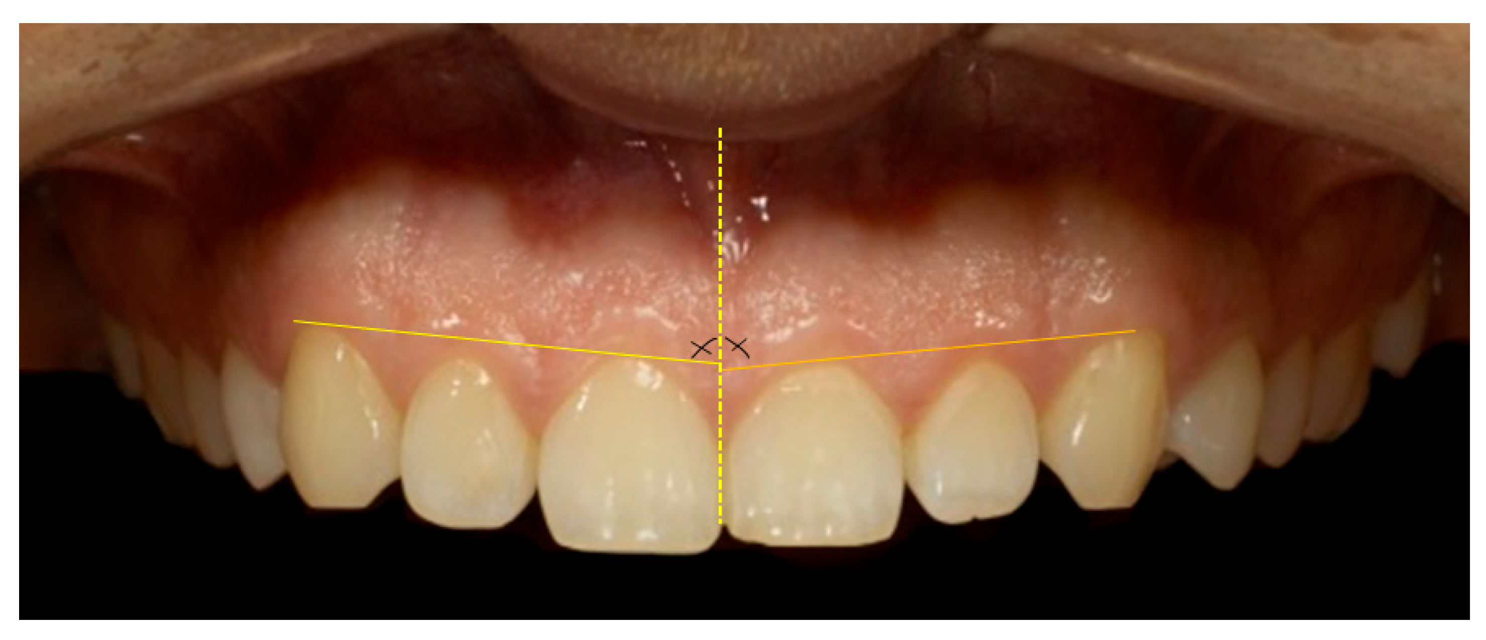 Dentistry 13 00380 g015