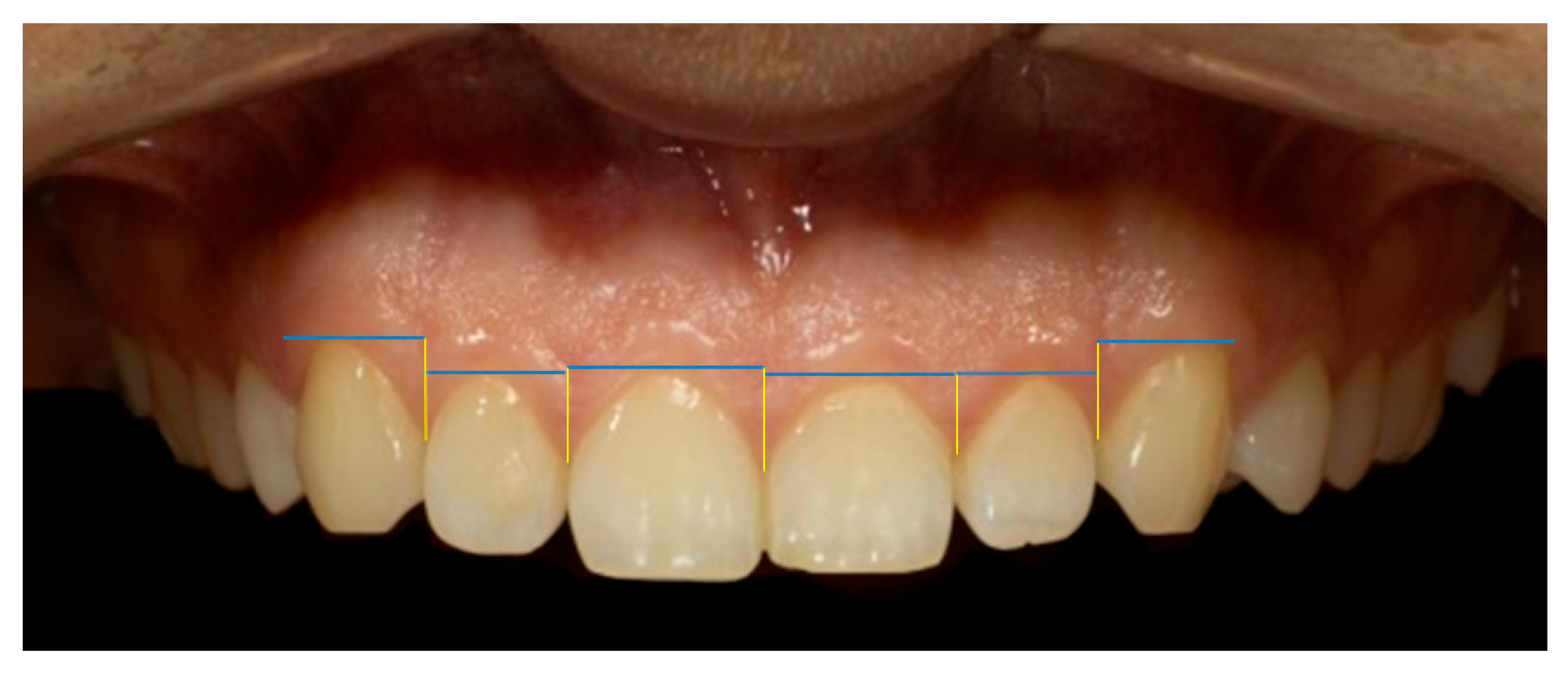 Dentistry 13 00380 g016