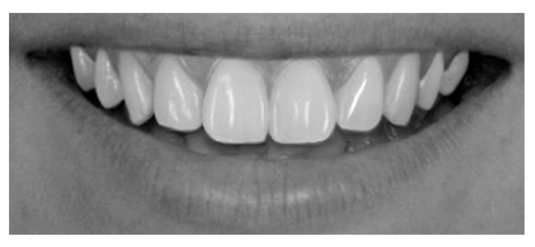 Dentistry 13 00380 g017