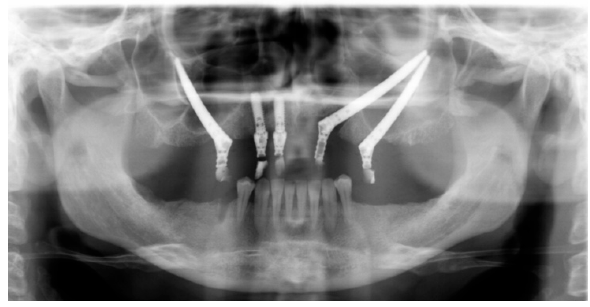 Dentistry 13 00381 g003