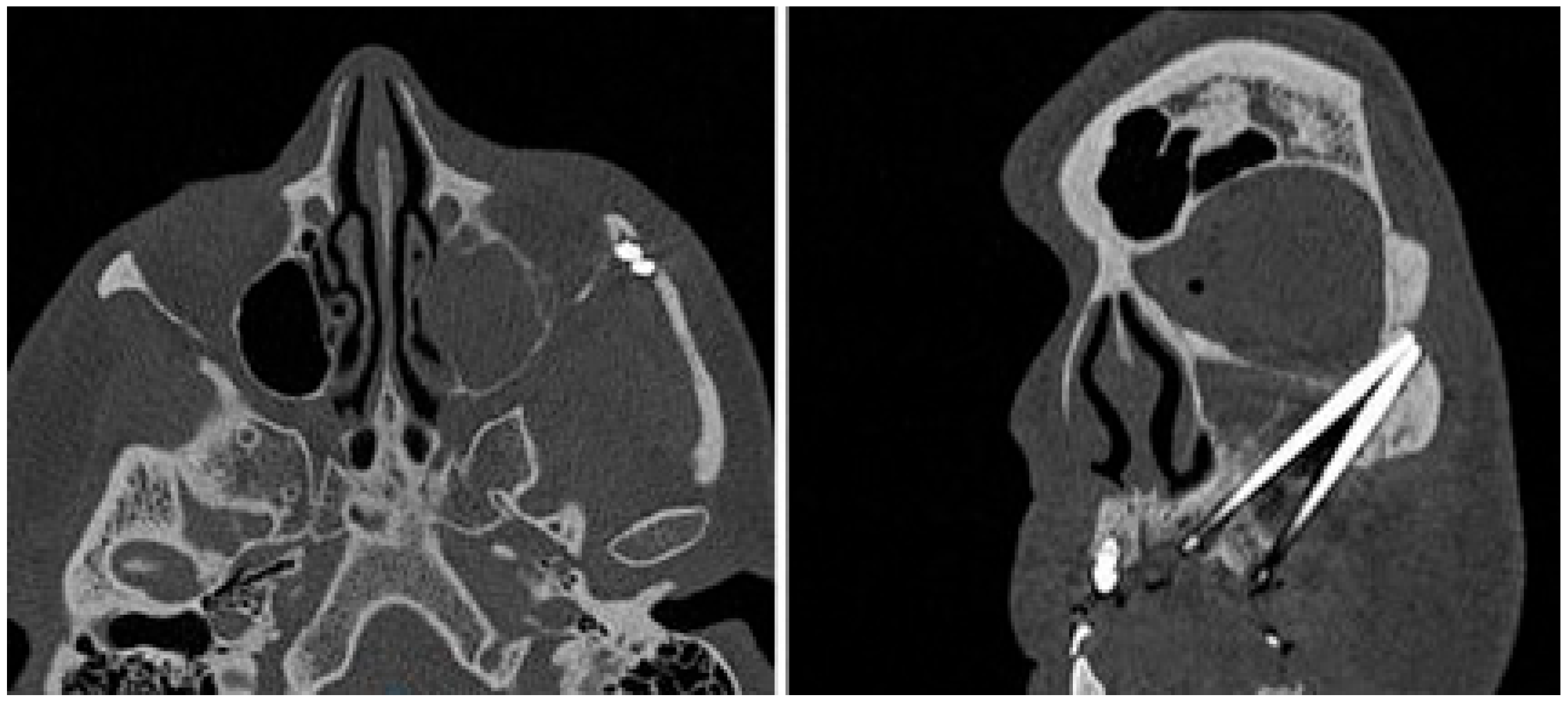 Dentistry 13 00381 g004