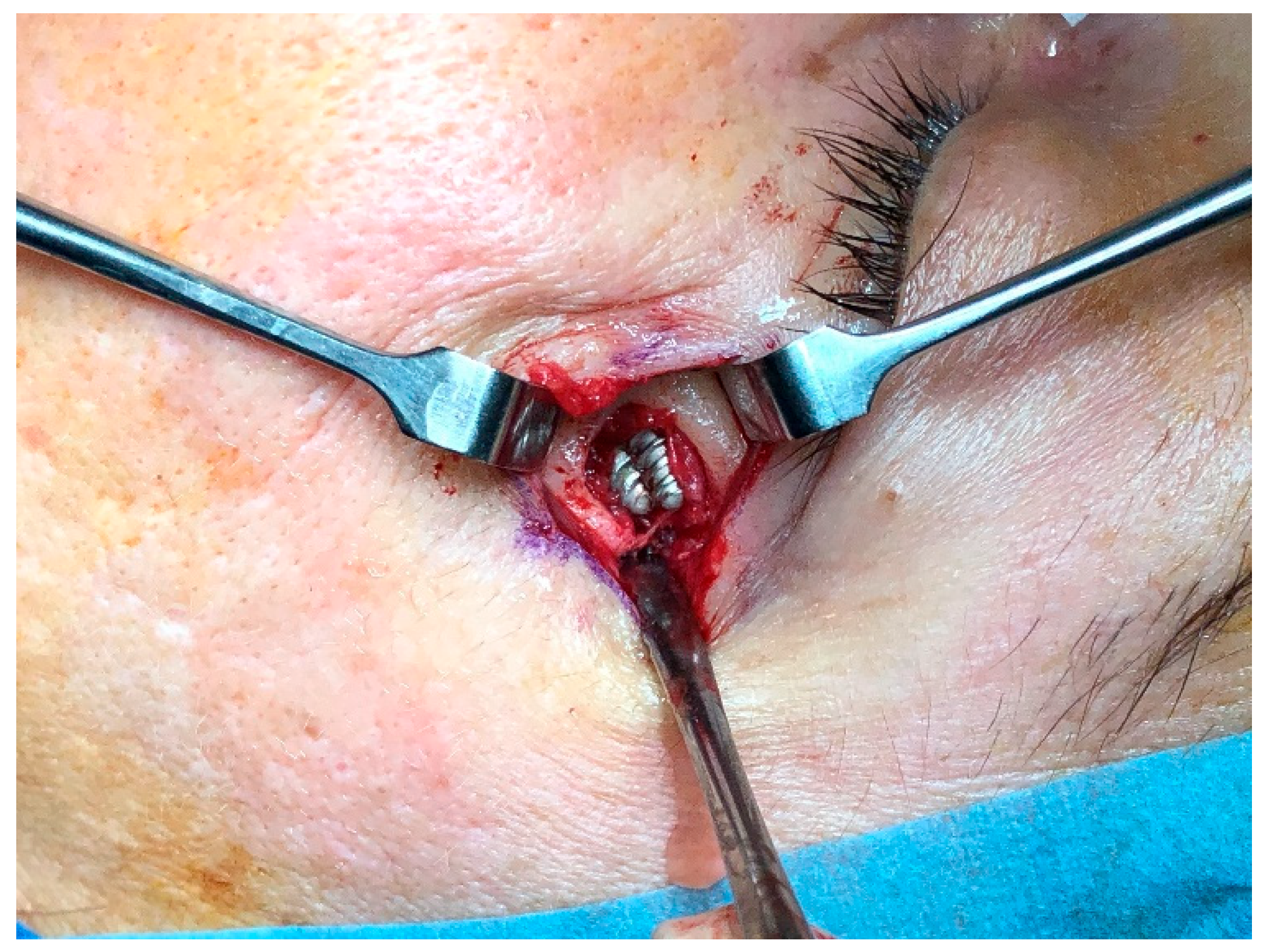 Dentistry 13 00381 g005