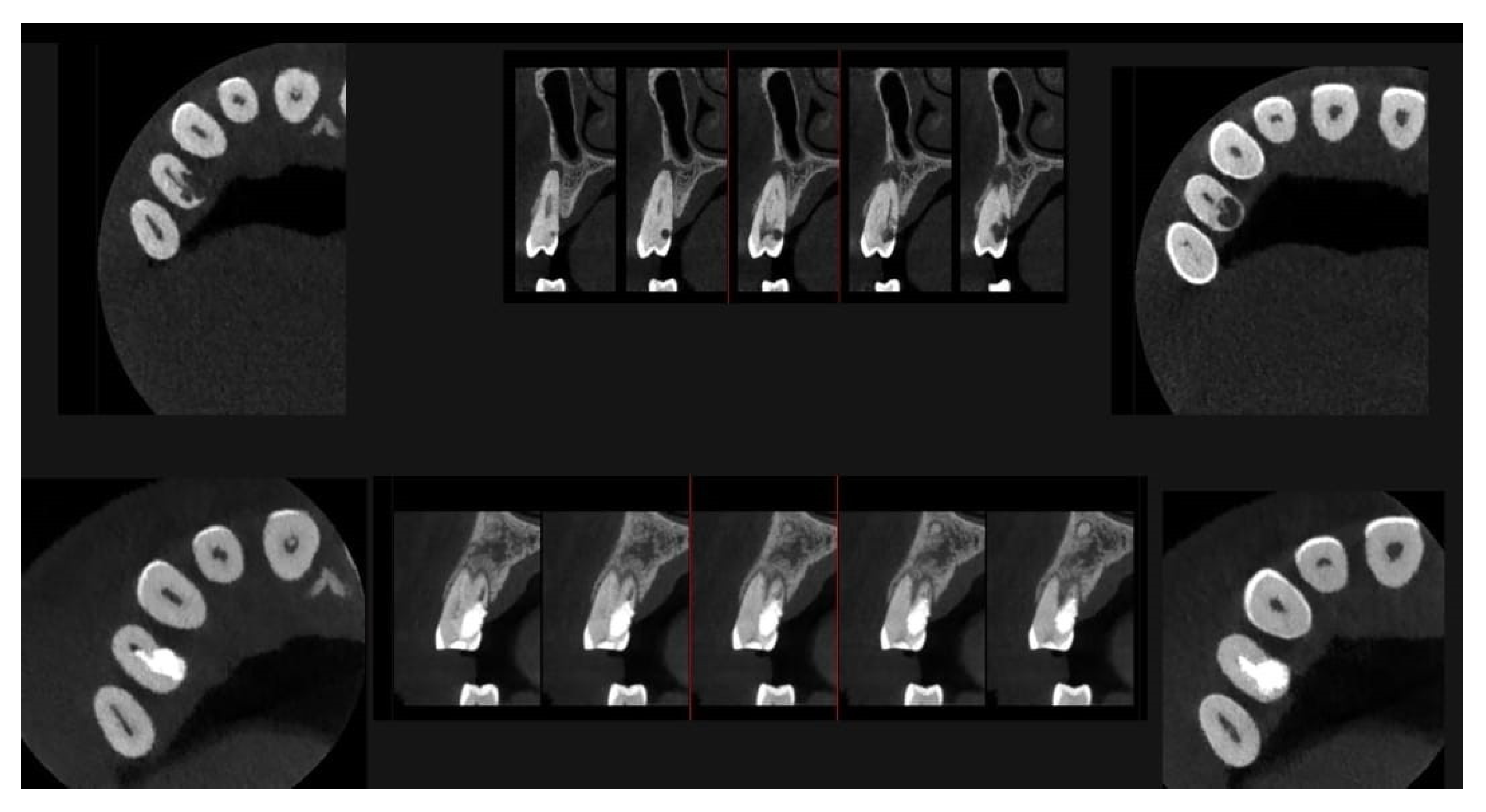 Dentistry 13 00388 g013