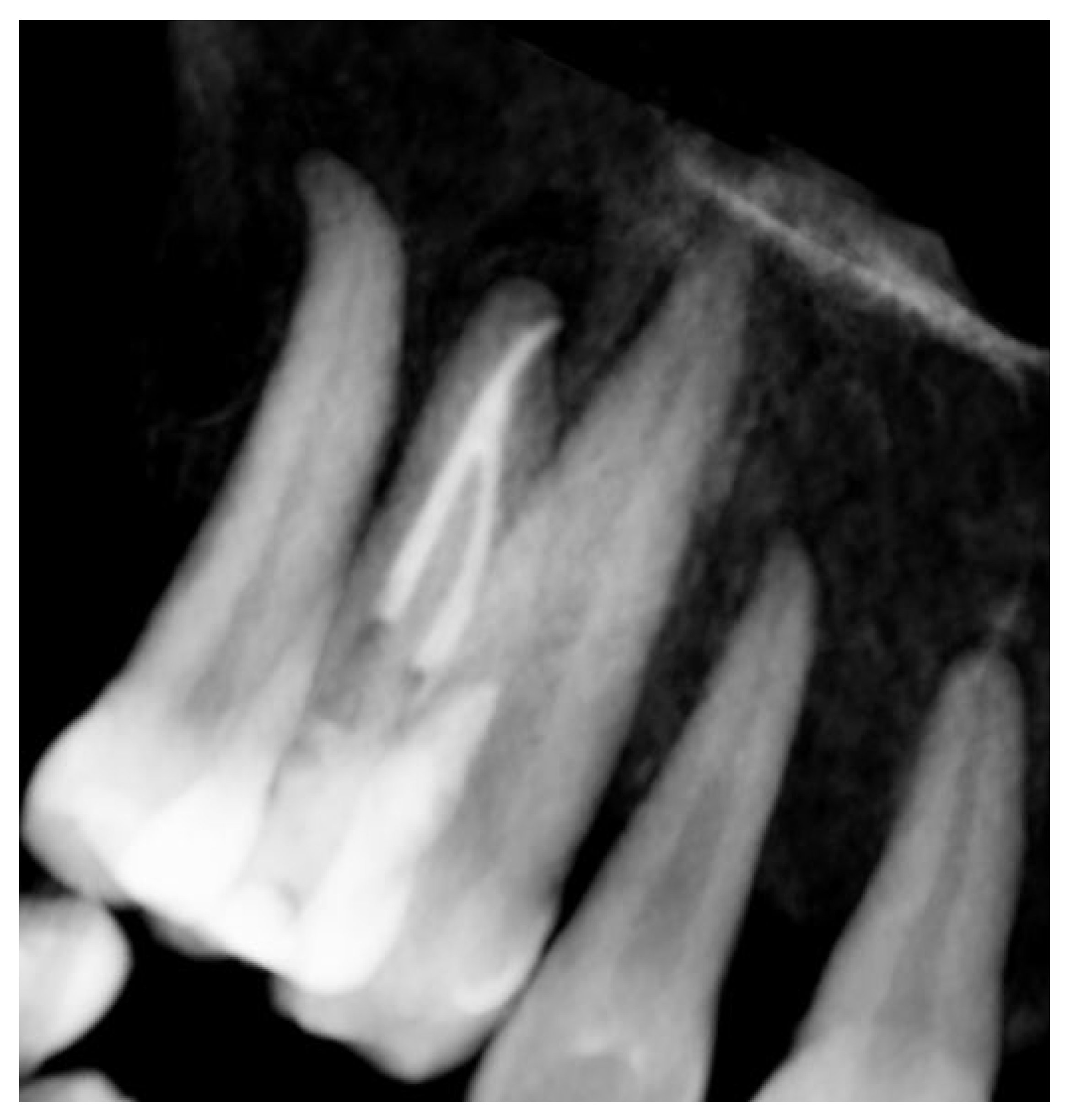 Dentistry 13 00388 g014