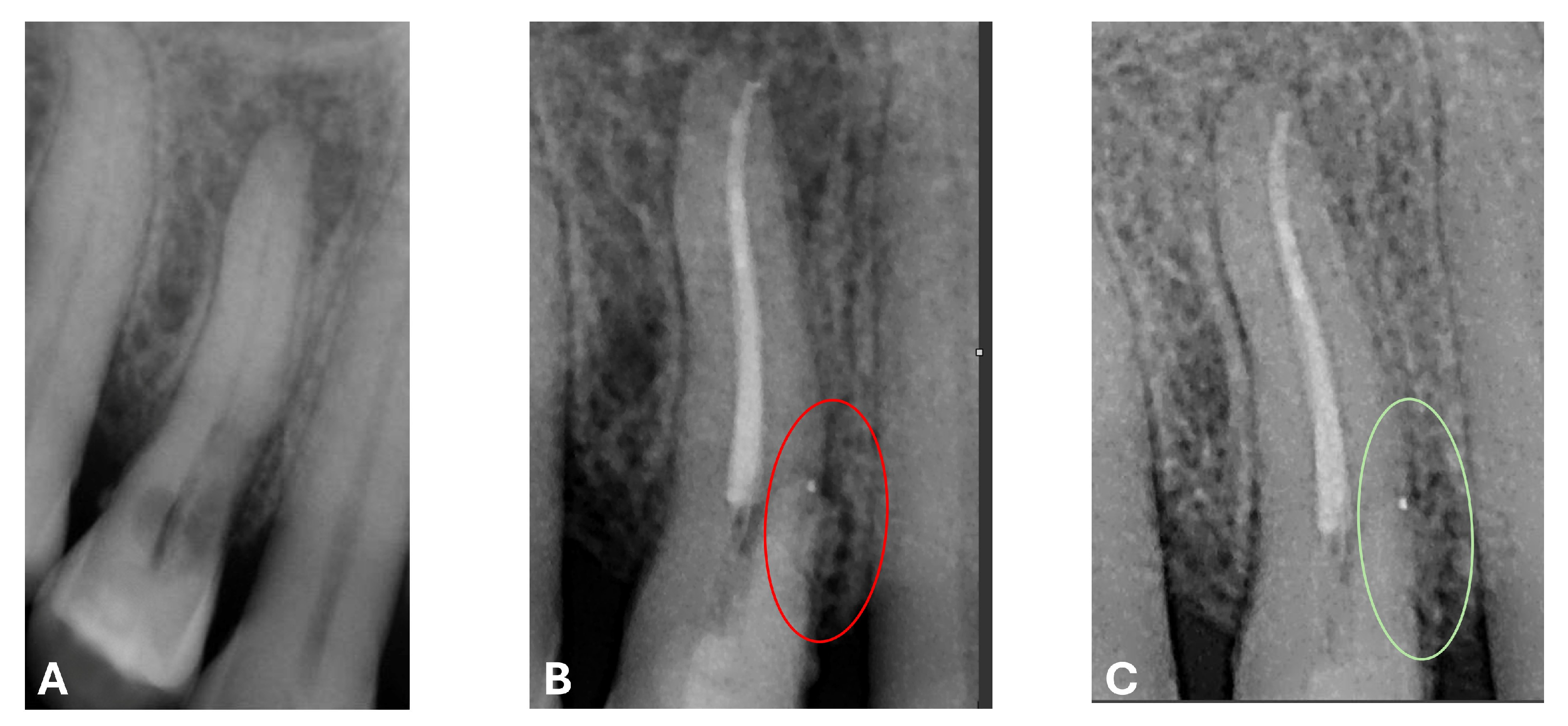 Dentistry 13 00388 g017