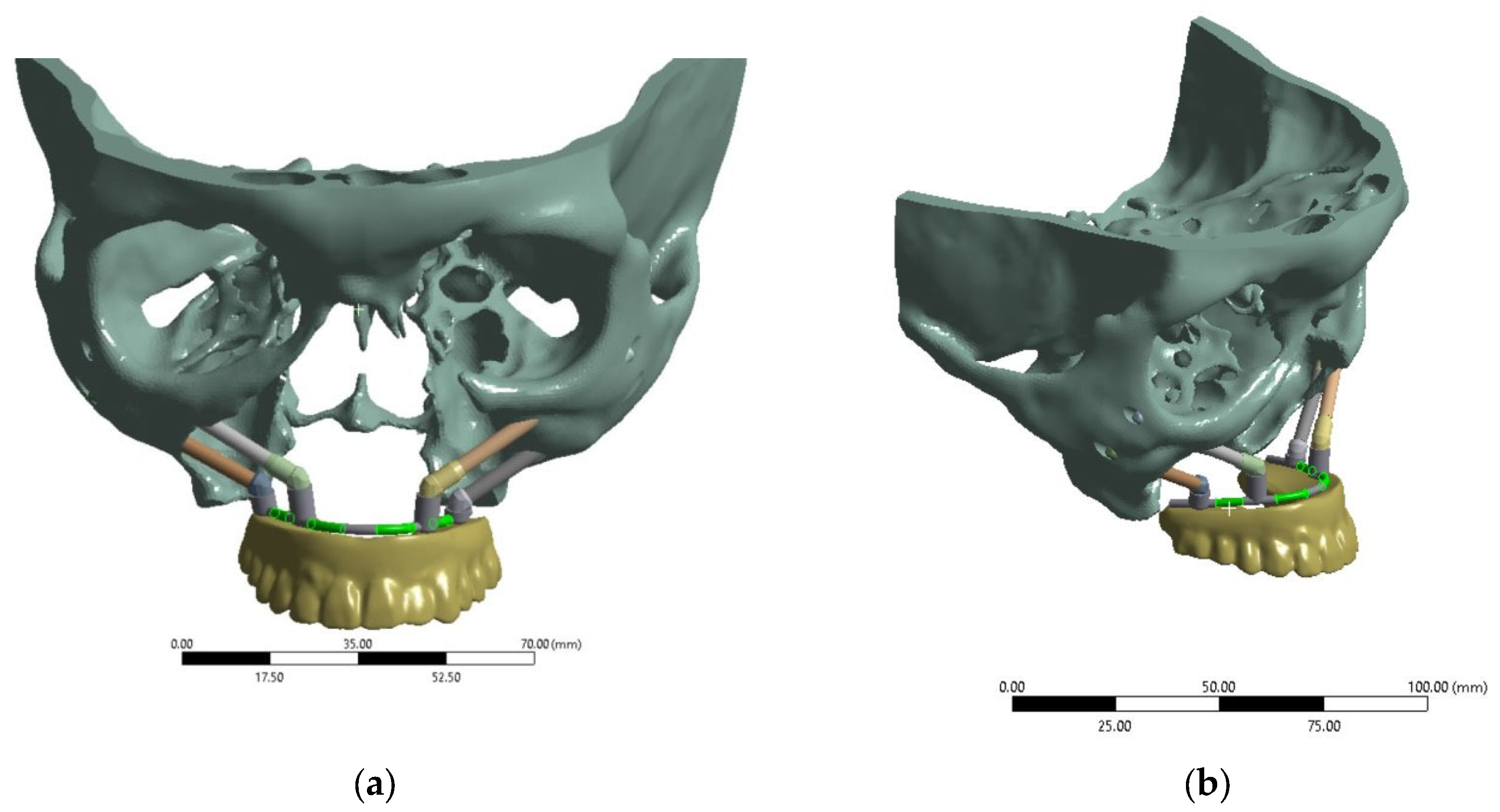 Dentistry 13 00393 g001