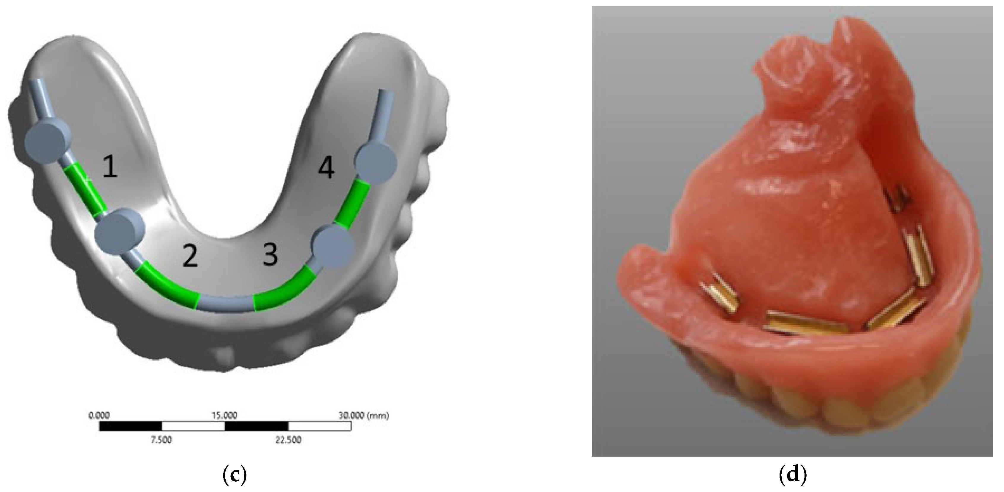 Dentistry 13 00393 g003b