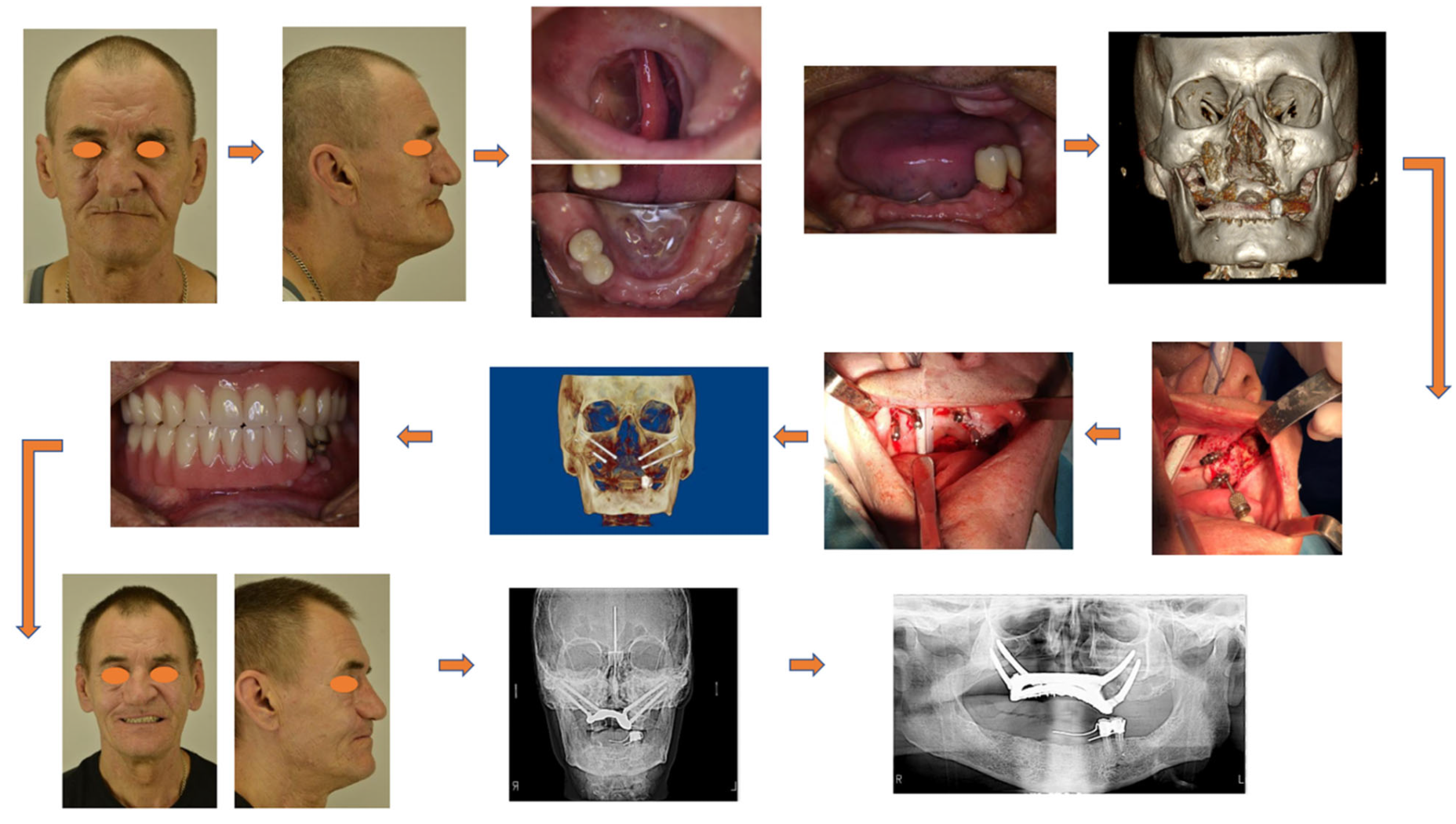 Dentistry 13 00393 g016
