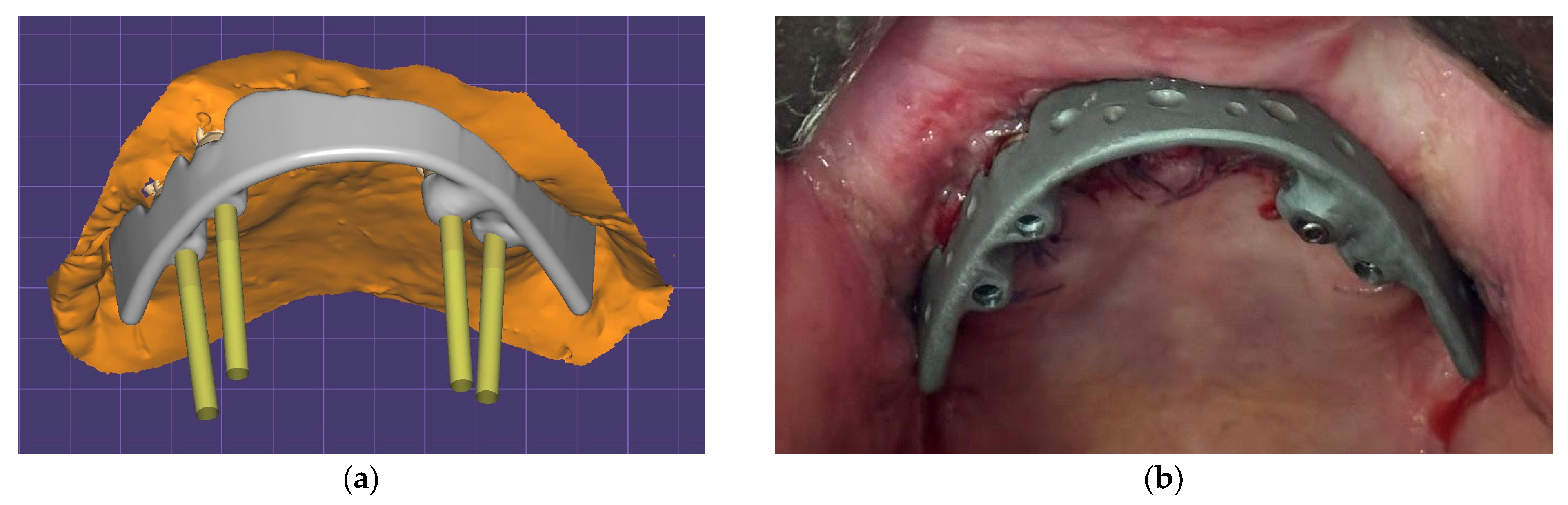 Dentistry 13 00393 g017