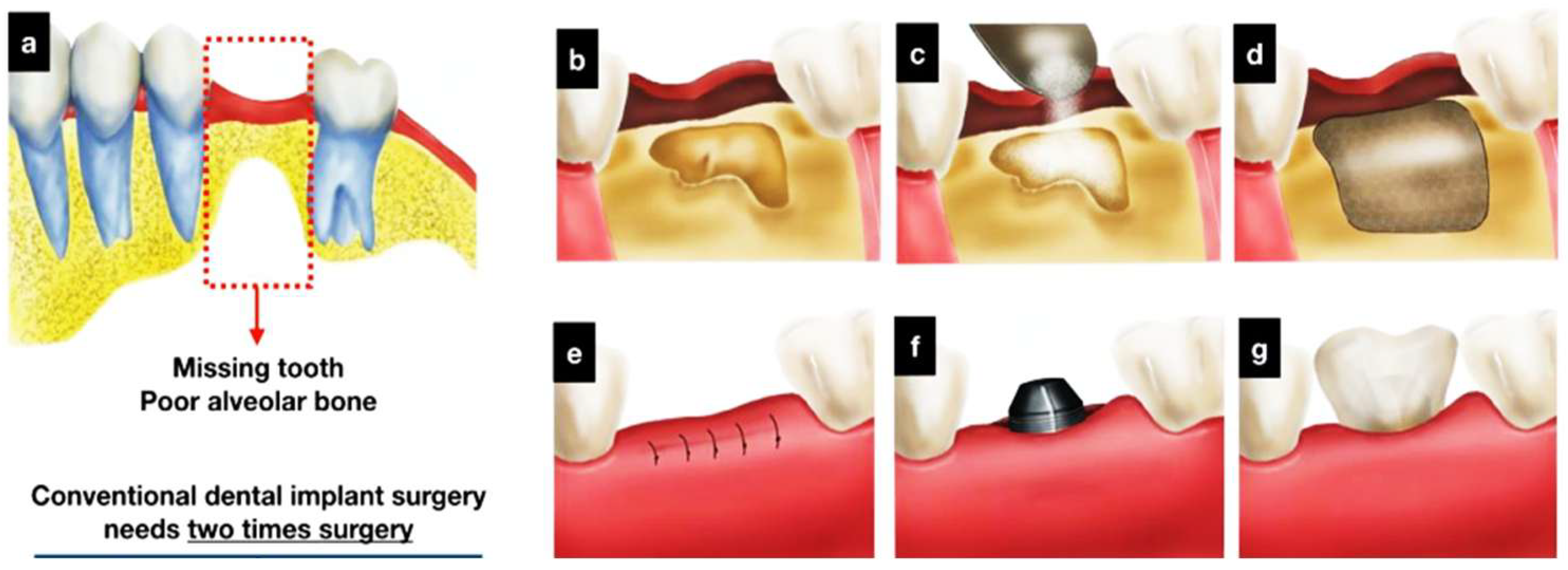 Dentistry 13 00396 g006