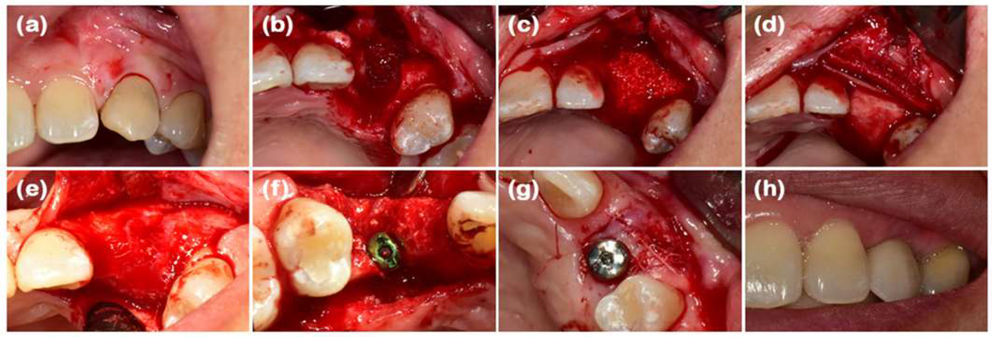 Dentistry 13 00396 g008