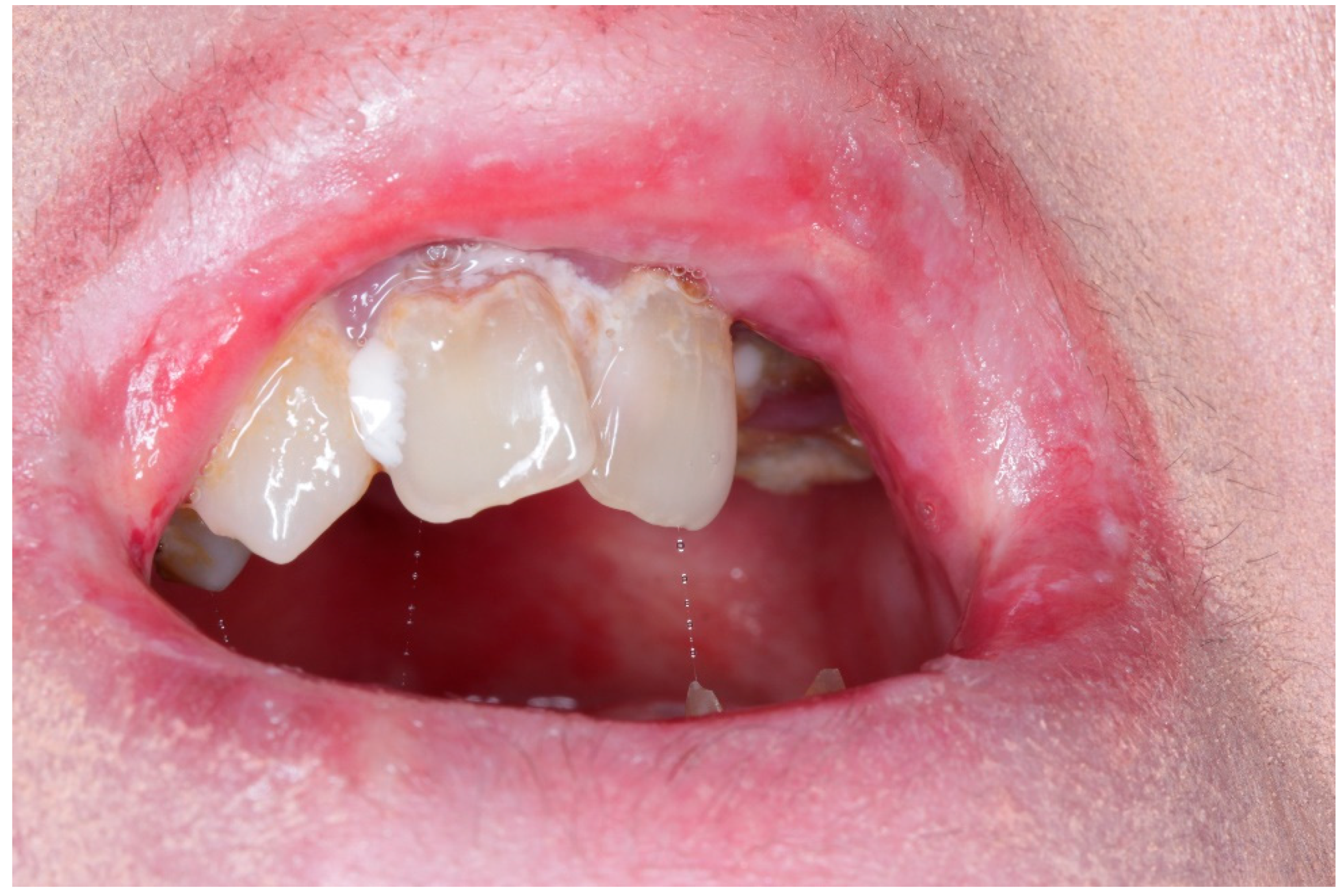 Dentistry 13 00398 g002