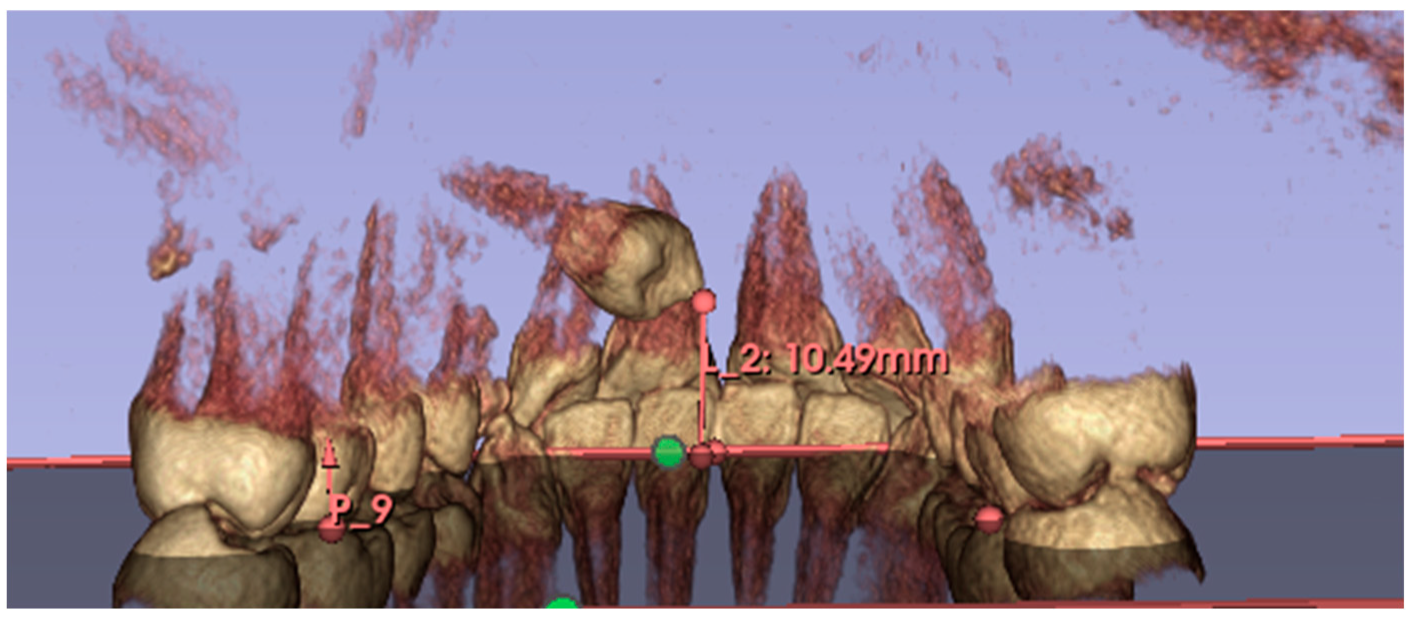 Dentistry 13 00399 g003