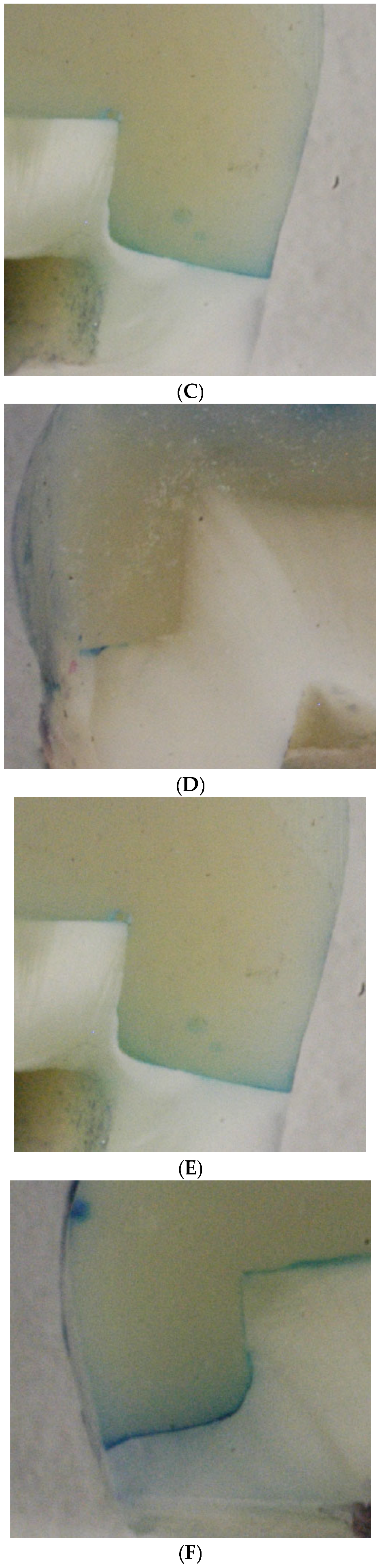 Dentistry 13 00406 g002b