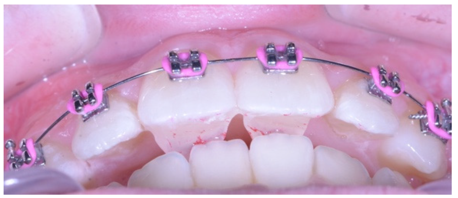 Dentistry 13 00412 g002