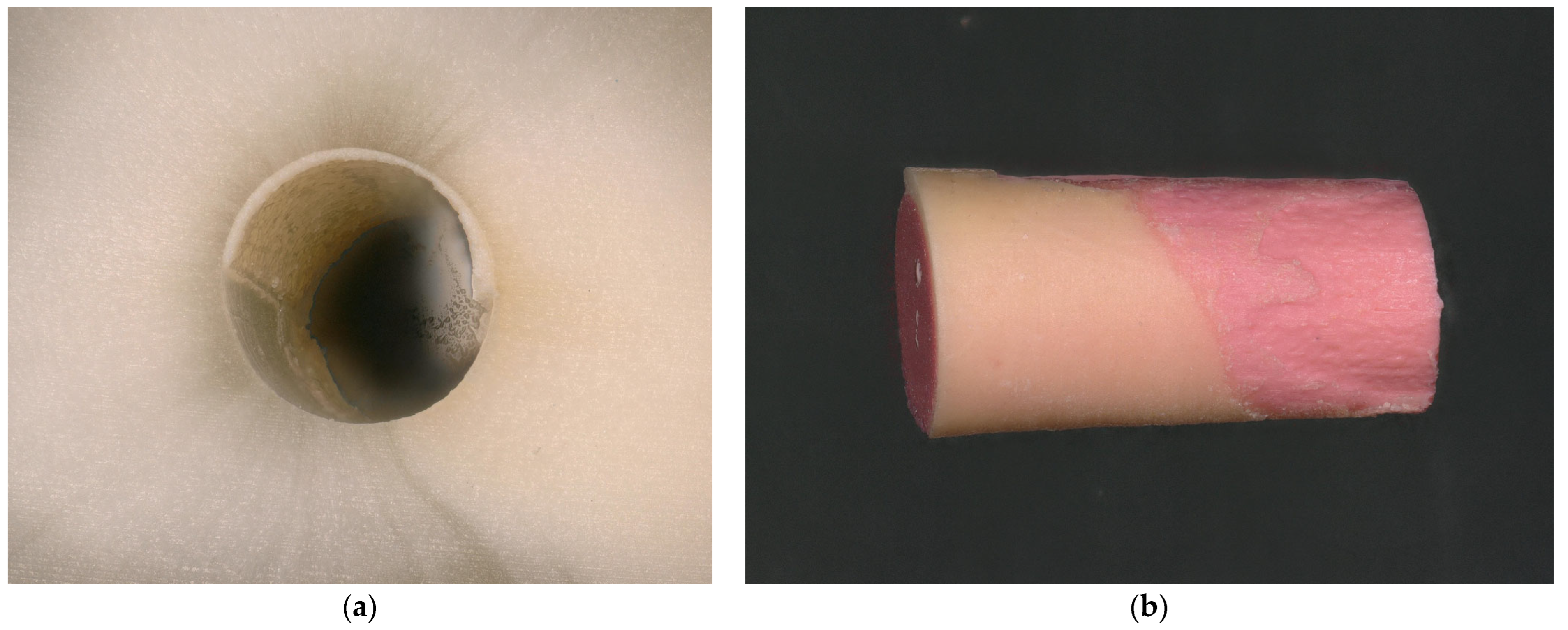 Dentistry 13 00415 g011 Dentistry 13 00415 g011