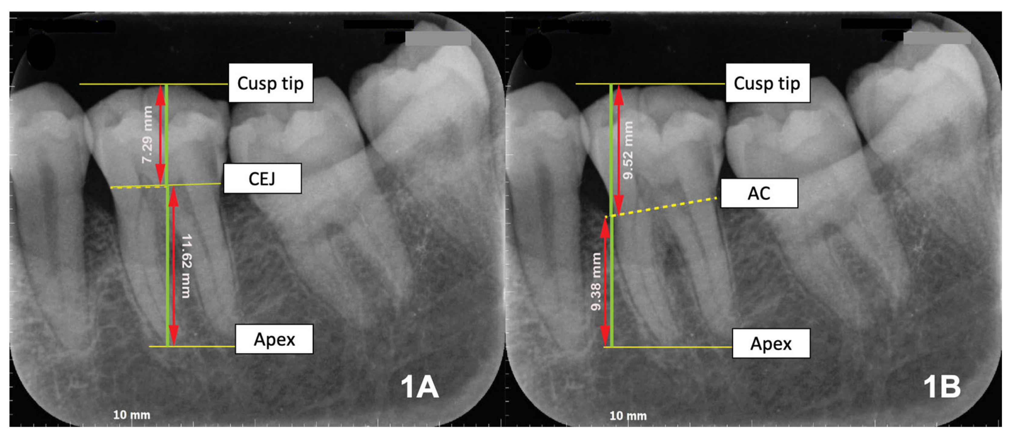Dentistry 13 00419 g001 Dentistry 13 00419 g001
