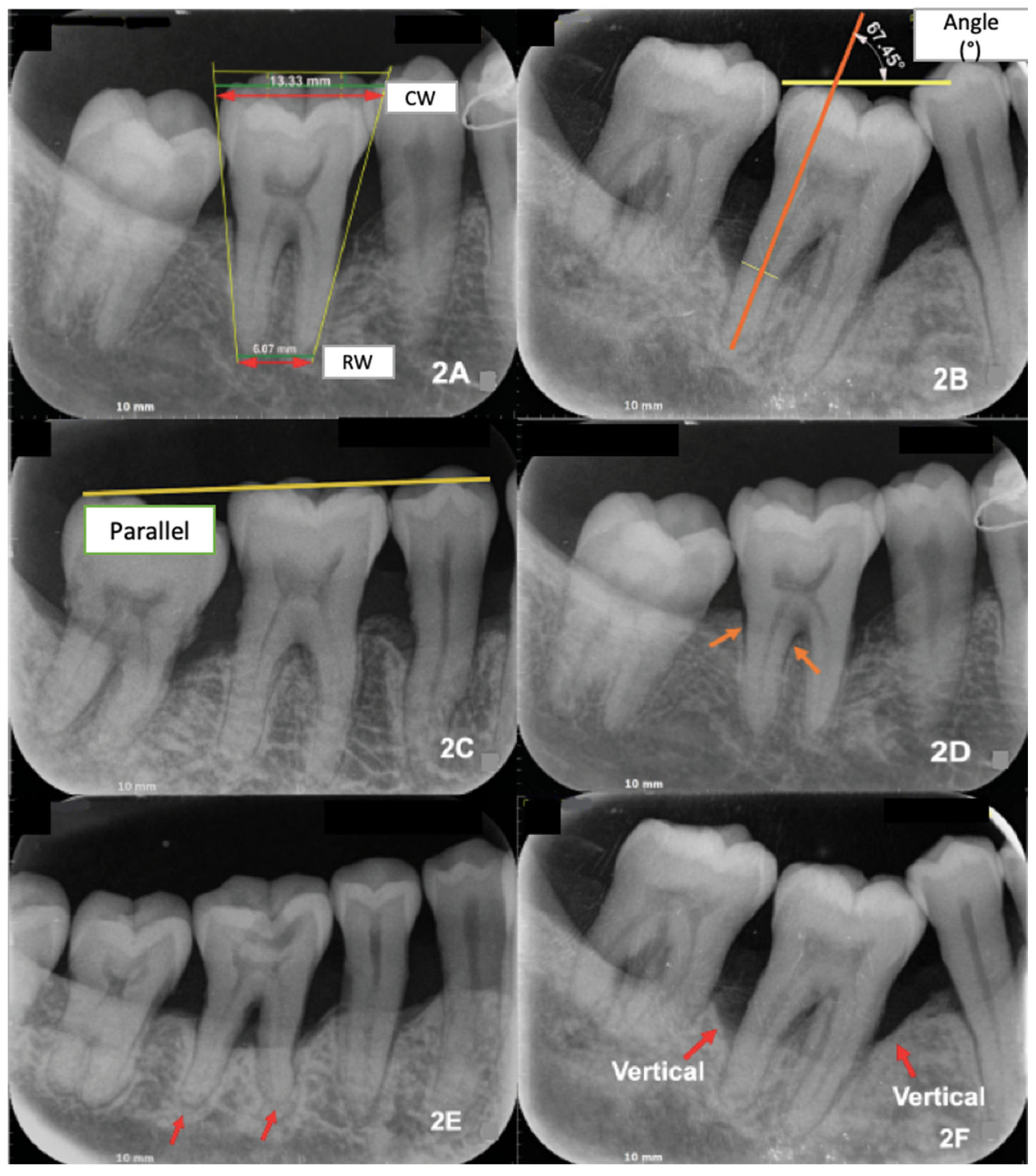 Dentistry 13 00419 g002 Dentistry 13 00419 g002