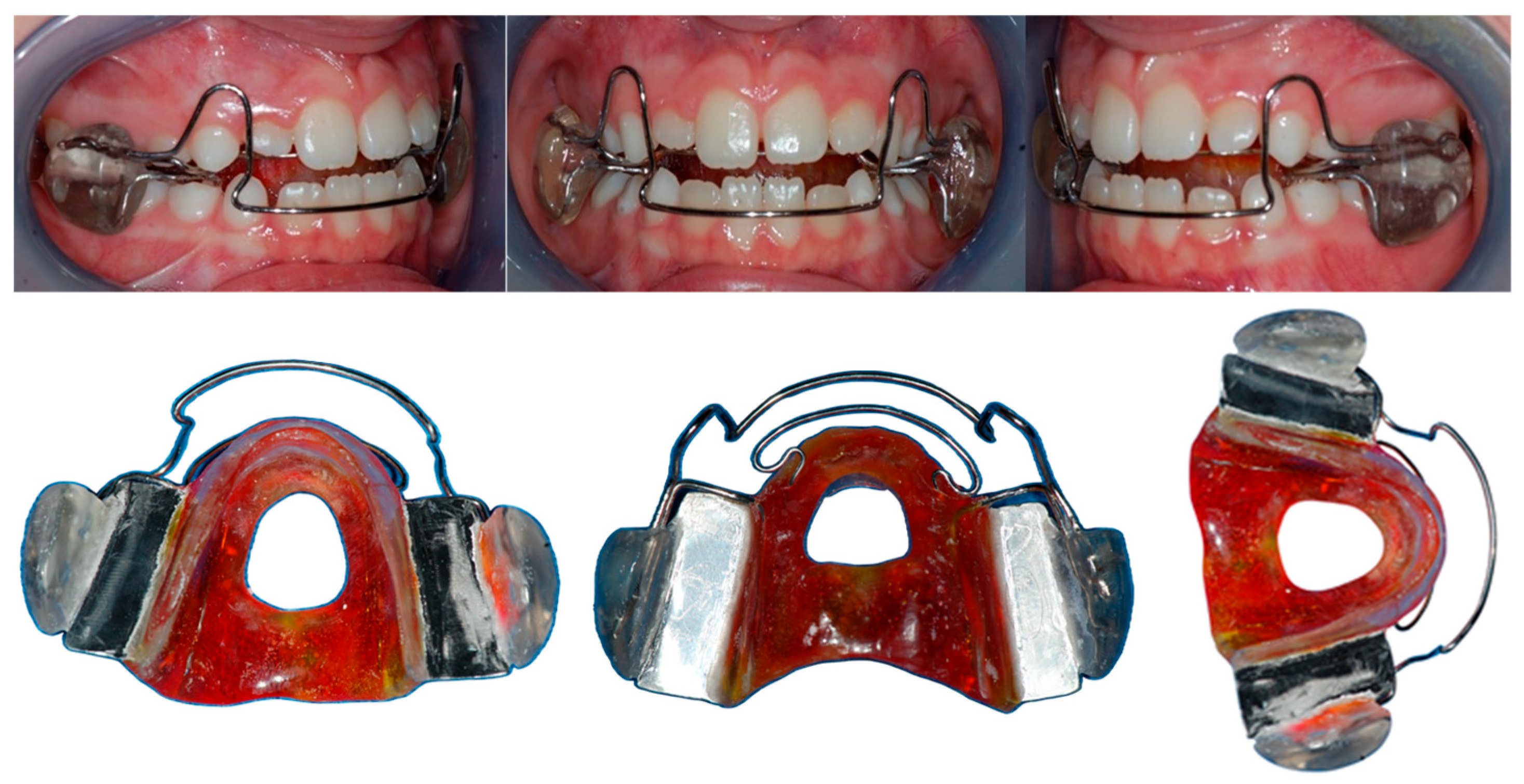 Dentistry 13 00427 g001