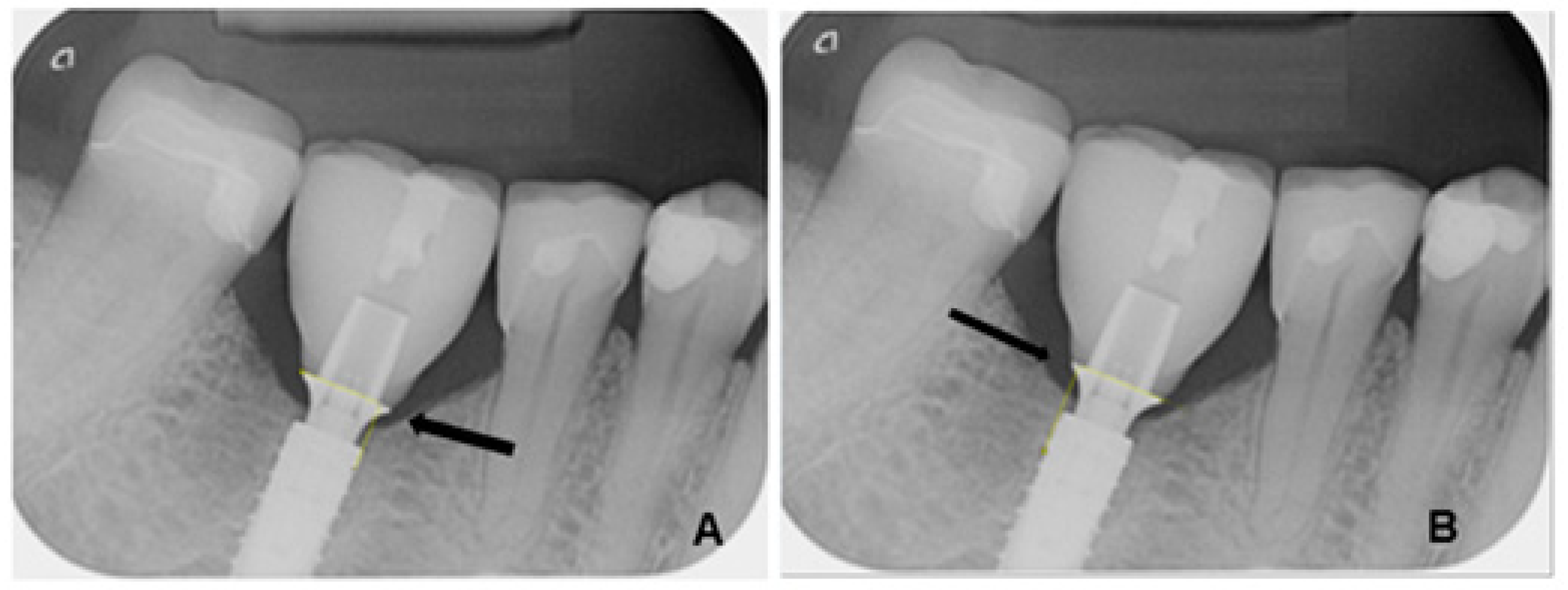 Dentistry 13 00430 g001