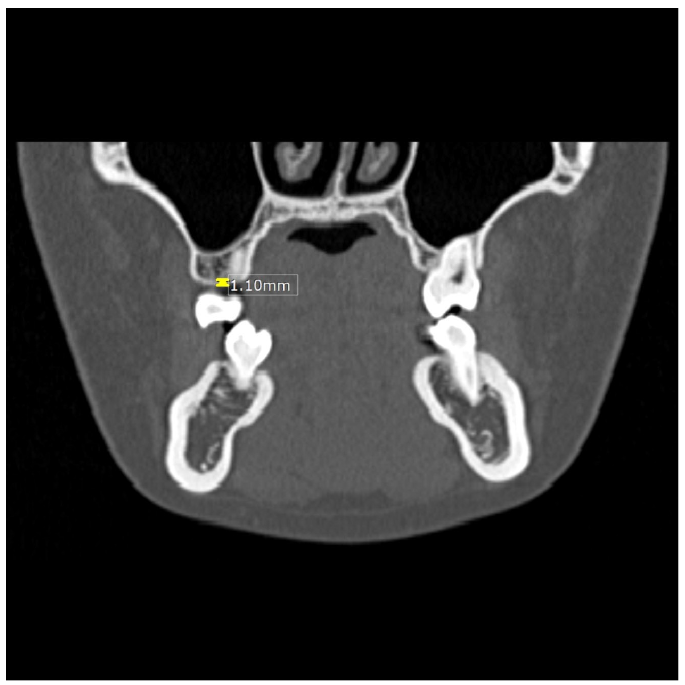 Dentistry 13 00437 g001