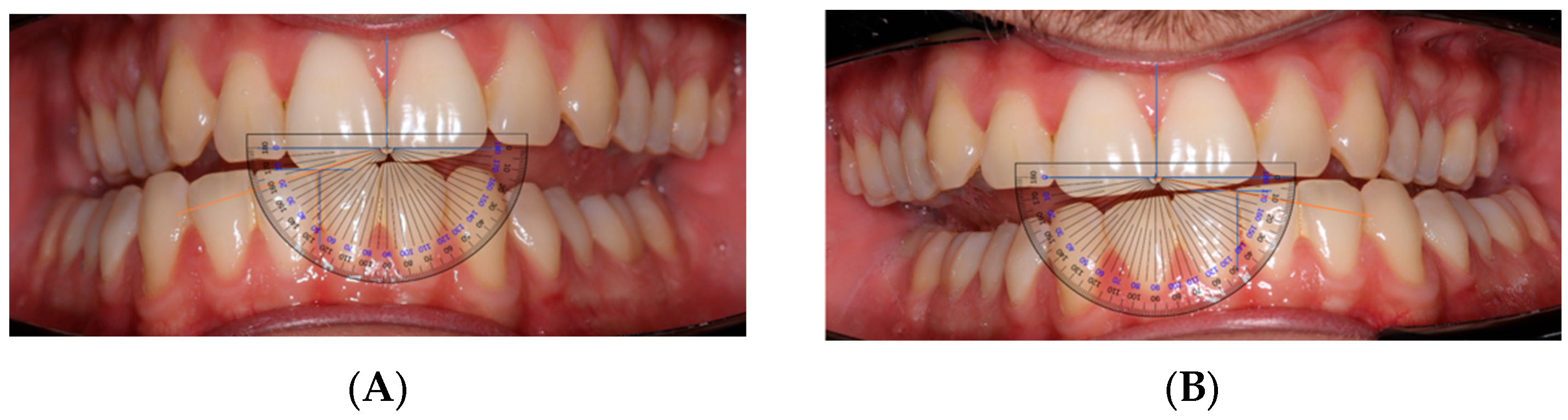 Dentistry 13 00451 g001