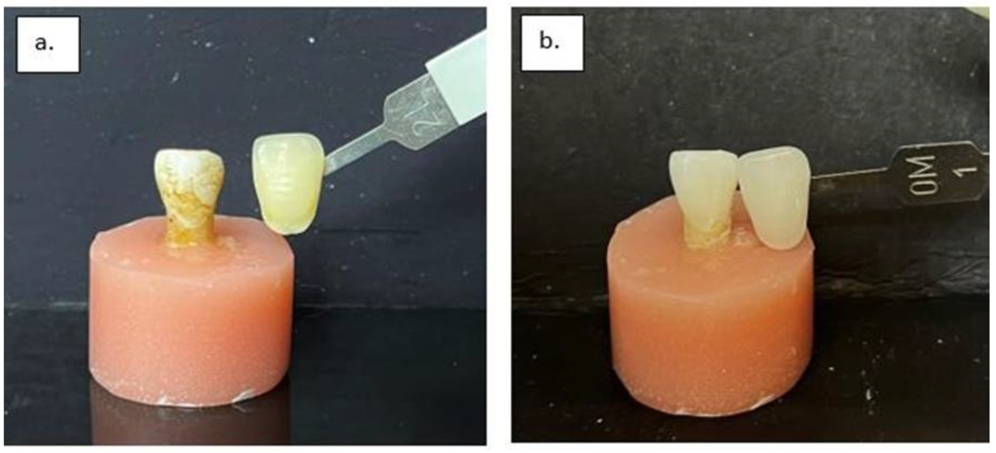 Dentistry 13 00452 g005