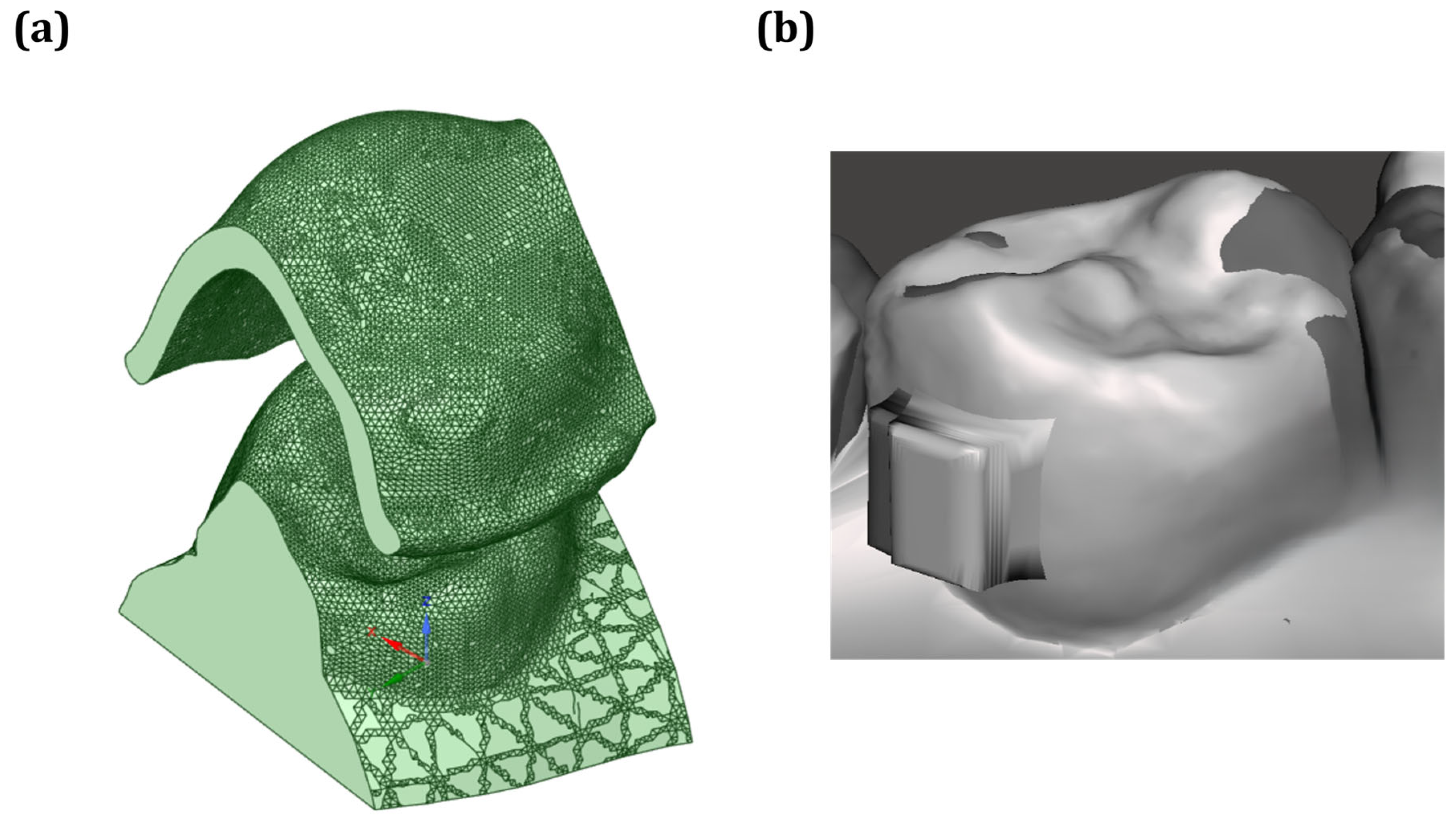 Dentistry 13 00454 g004 Dentistry 13 00454 g004