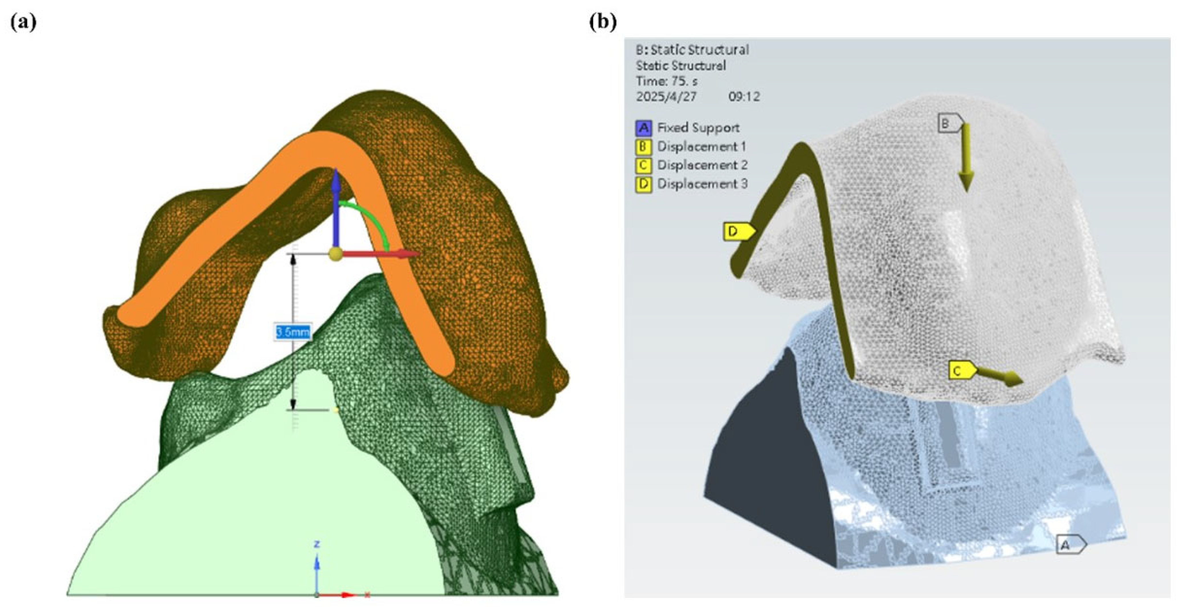 Dentistry 13 00454 g005 Dentistry 13 00454 g005