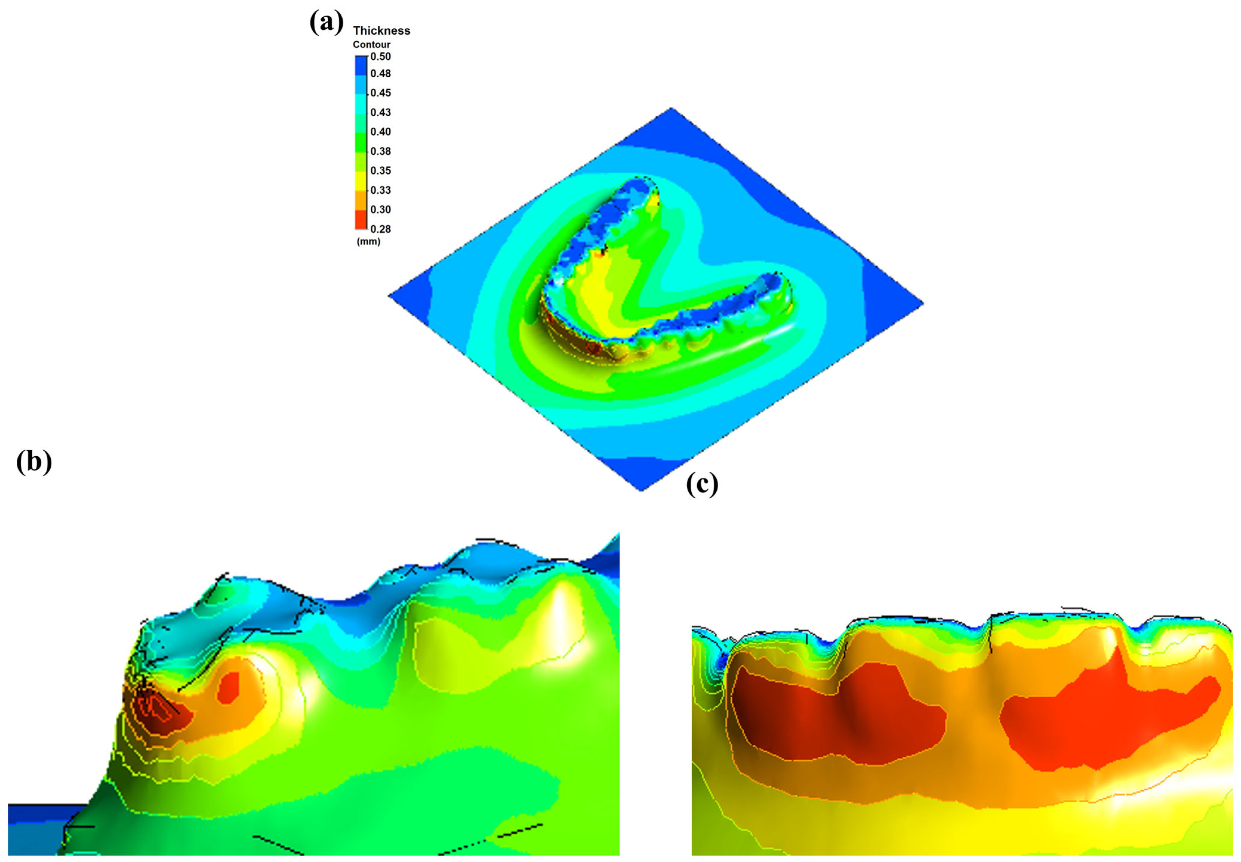 Dentistry 13 00454 g008 Dentistry 13 00454 g008