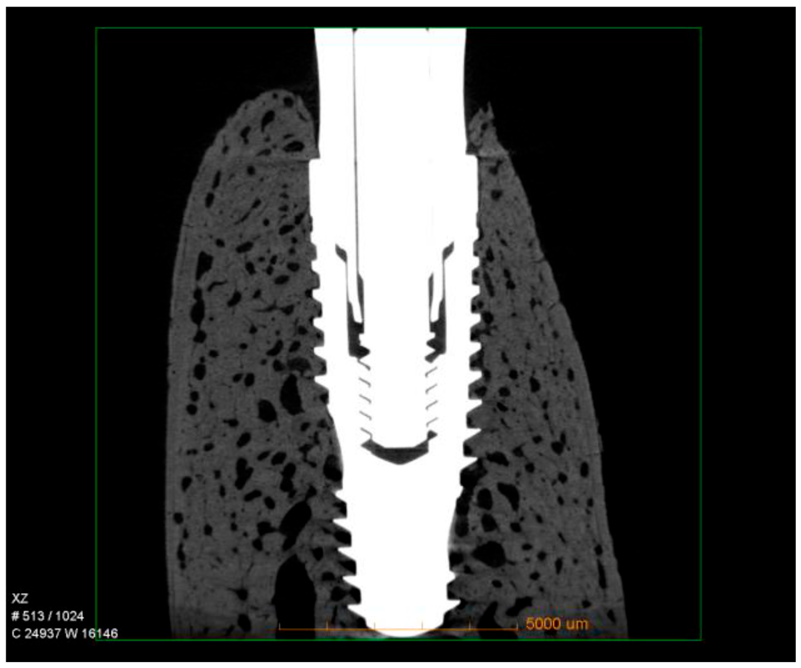 Dentistry 13 00463 g004