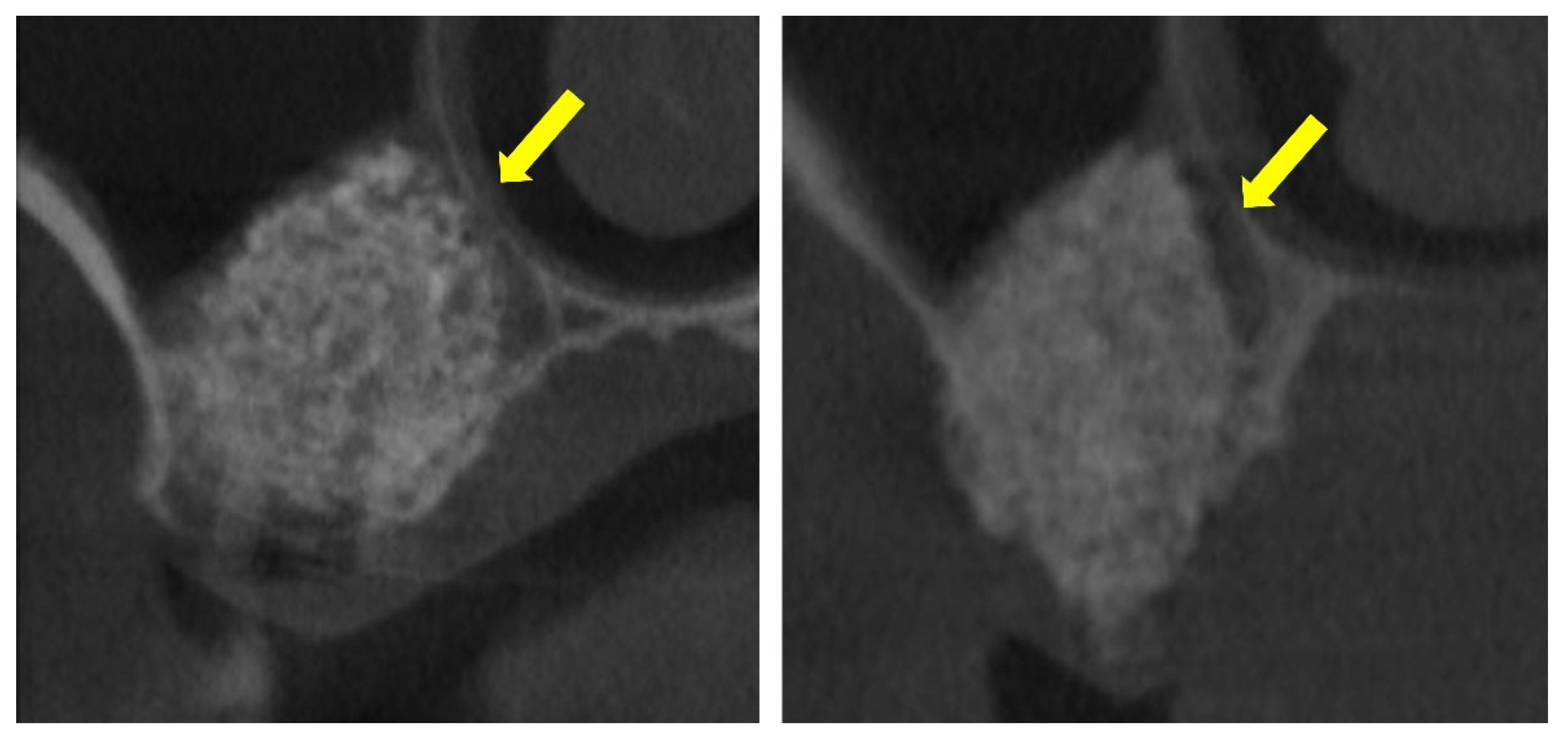 Dentistry 13 00472 g001