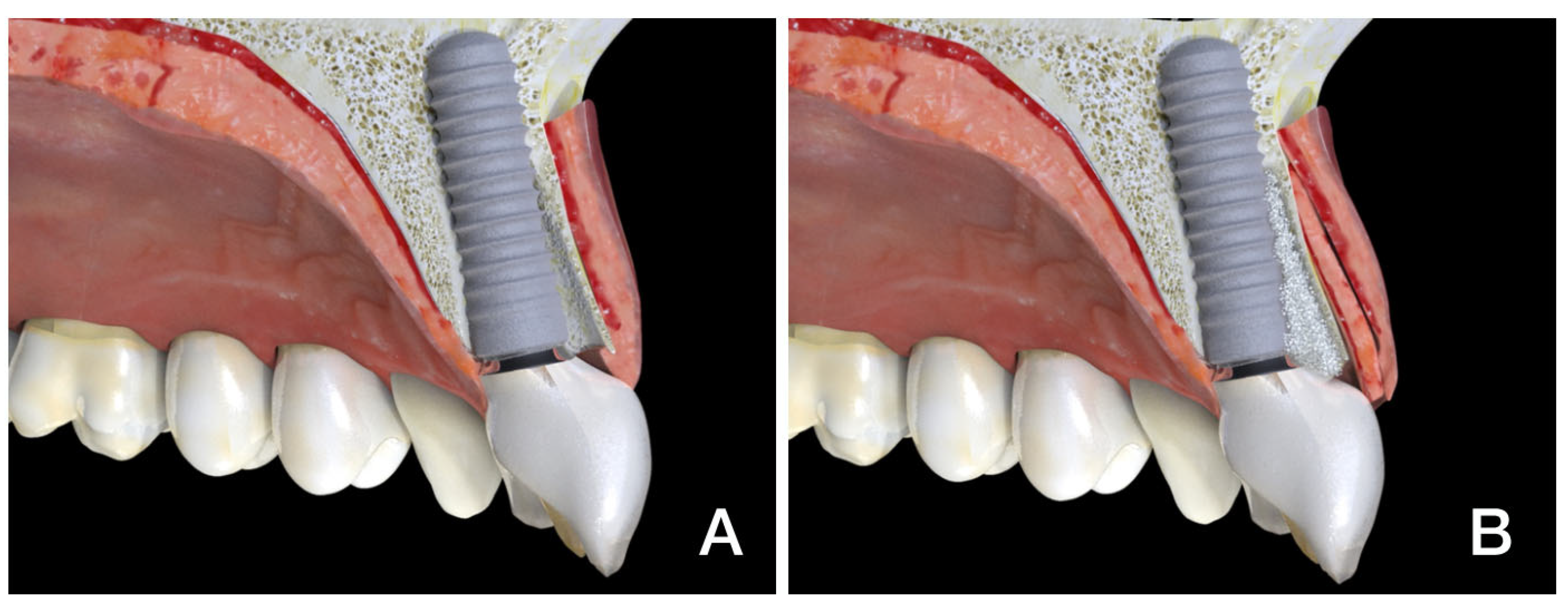 Dentistry 13 00478 g001