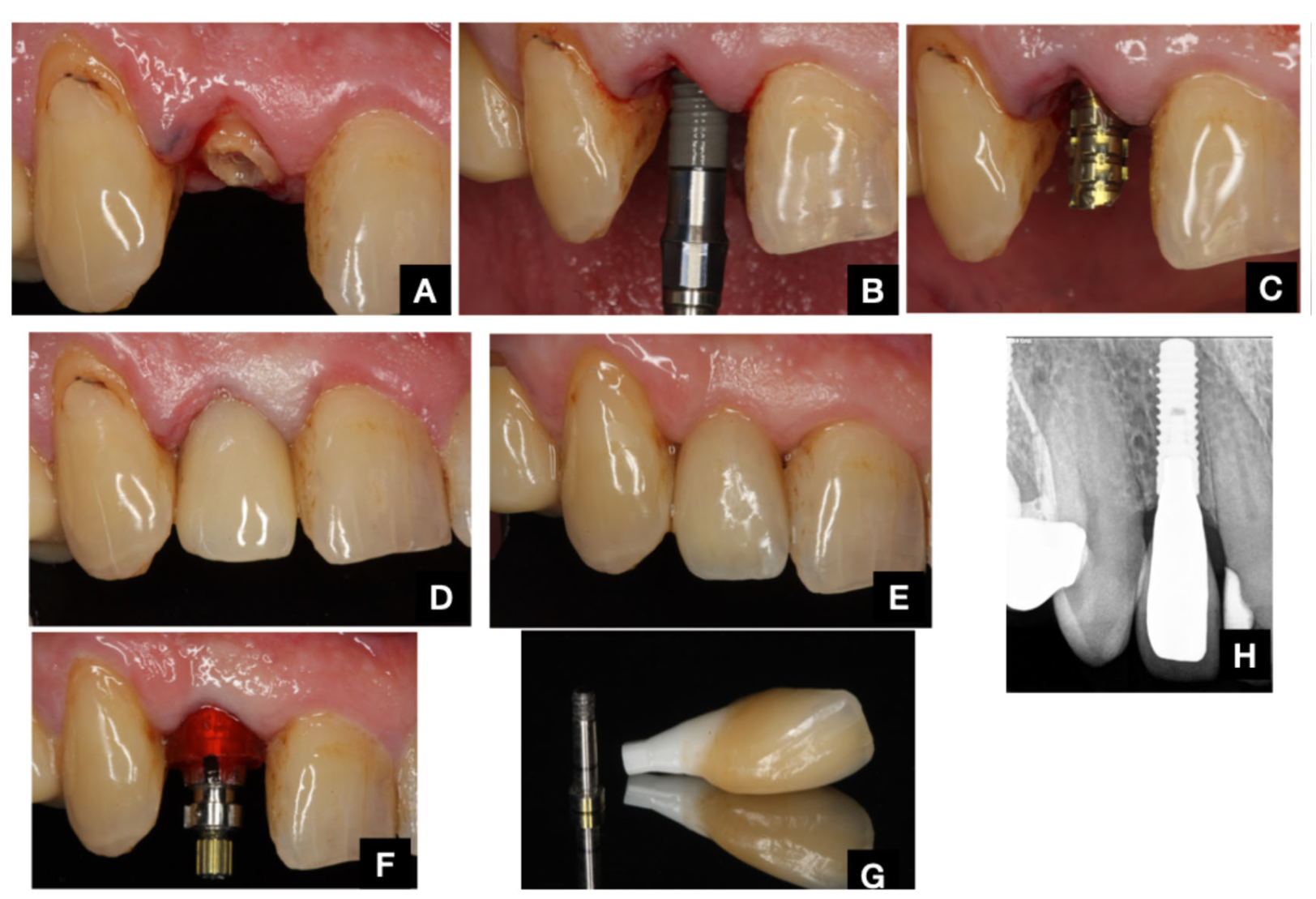 Dentistry 13 00478 g003