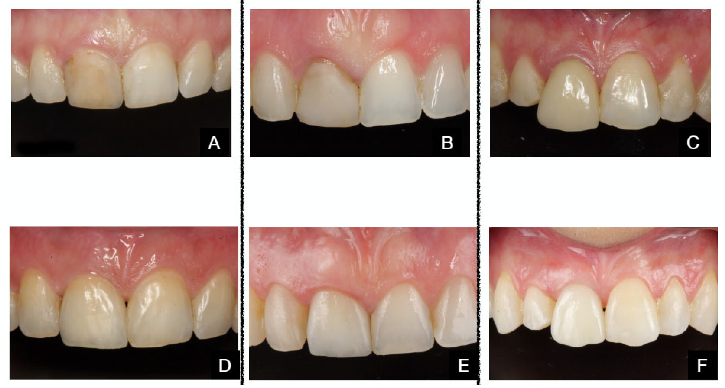 Dentistry 13 00478 g007