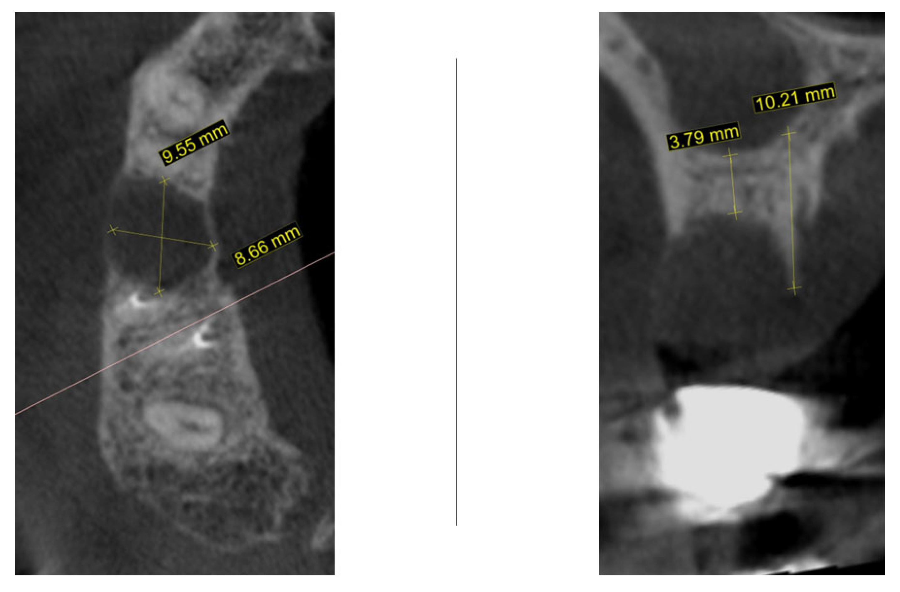 Dentistry 13 00483 g002