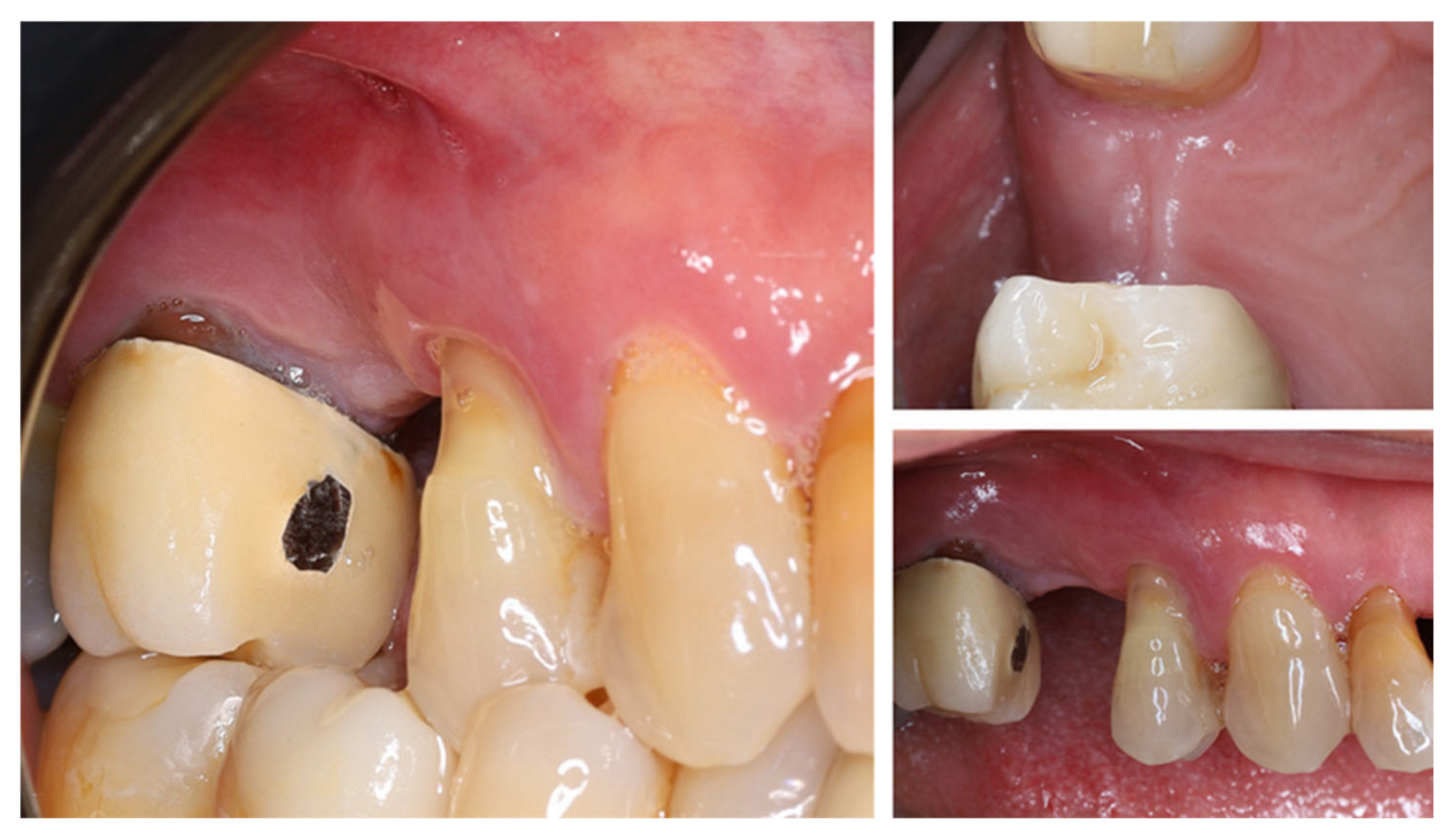 Dentistry 13 00483 g003