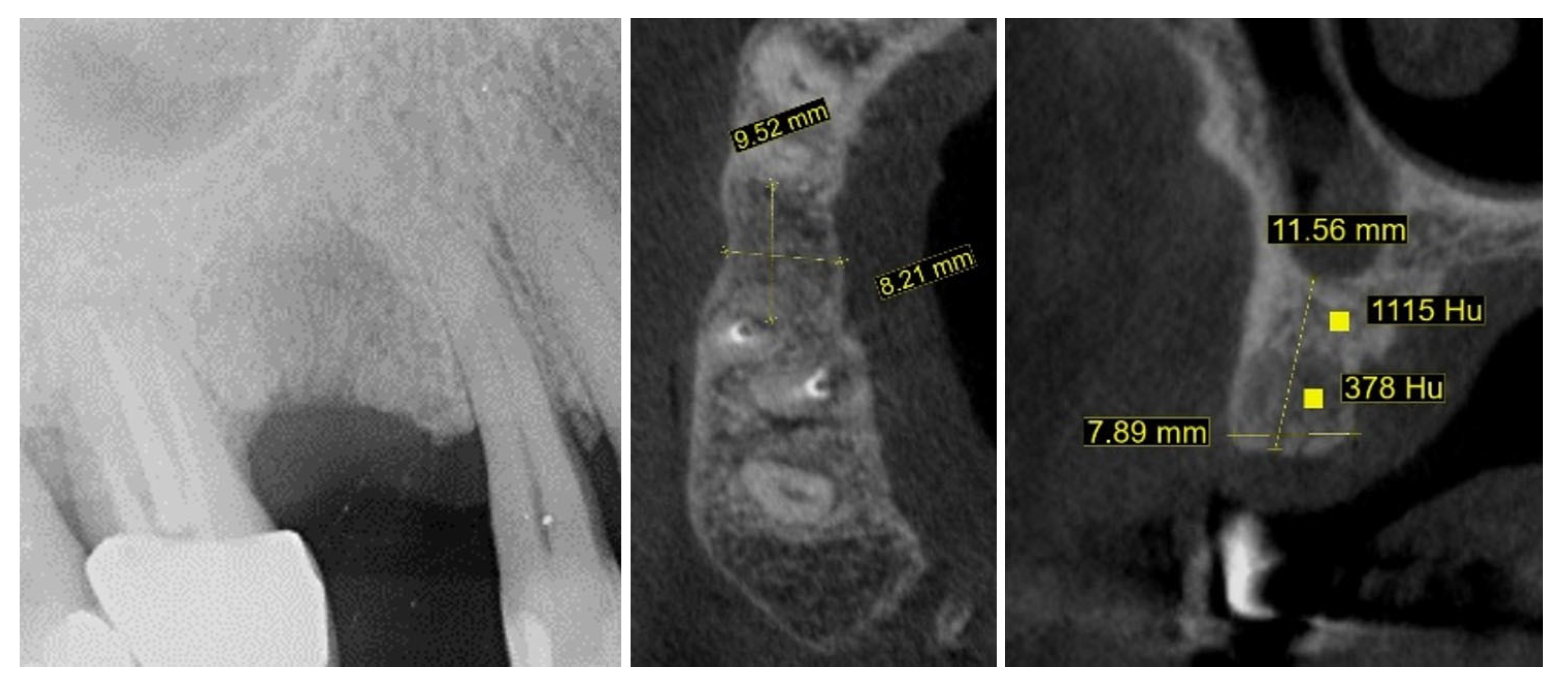 Dentistry 13 00483 g004
