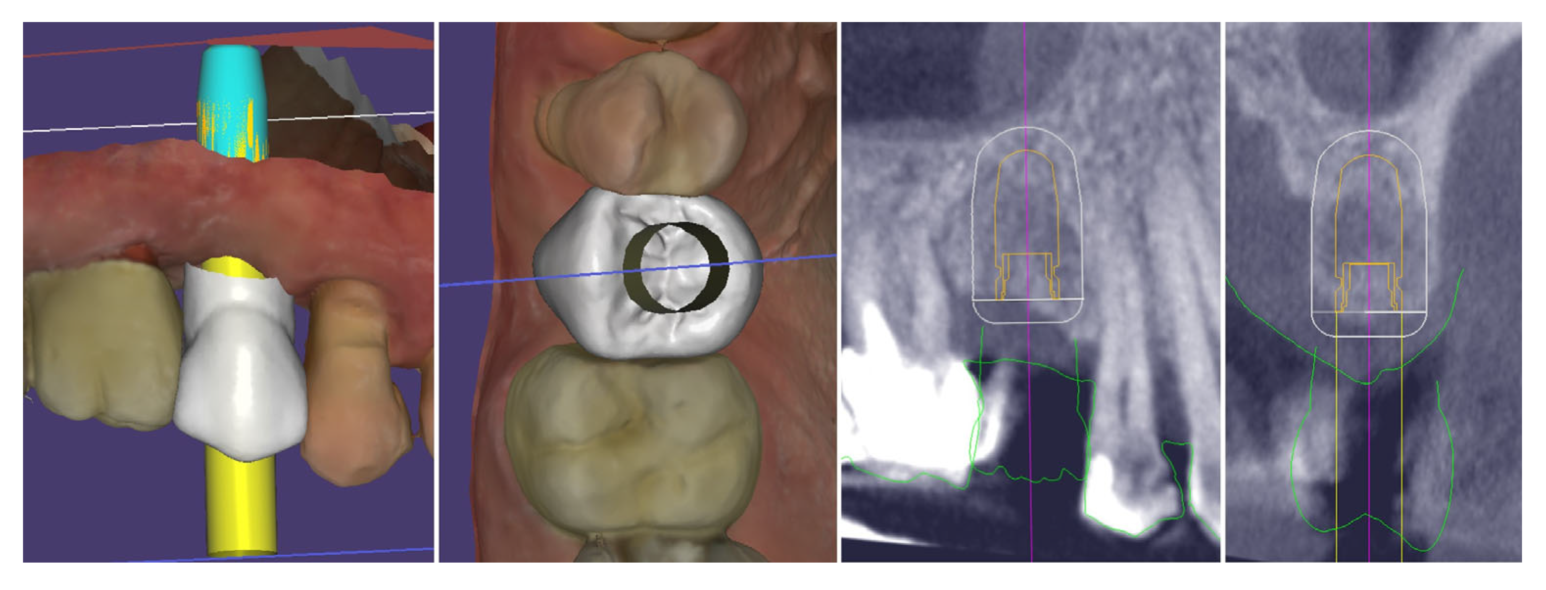 Dentistry 13 00483 g005