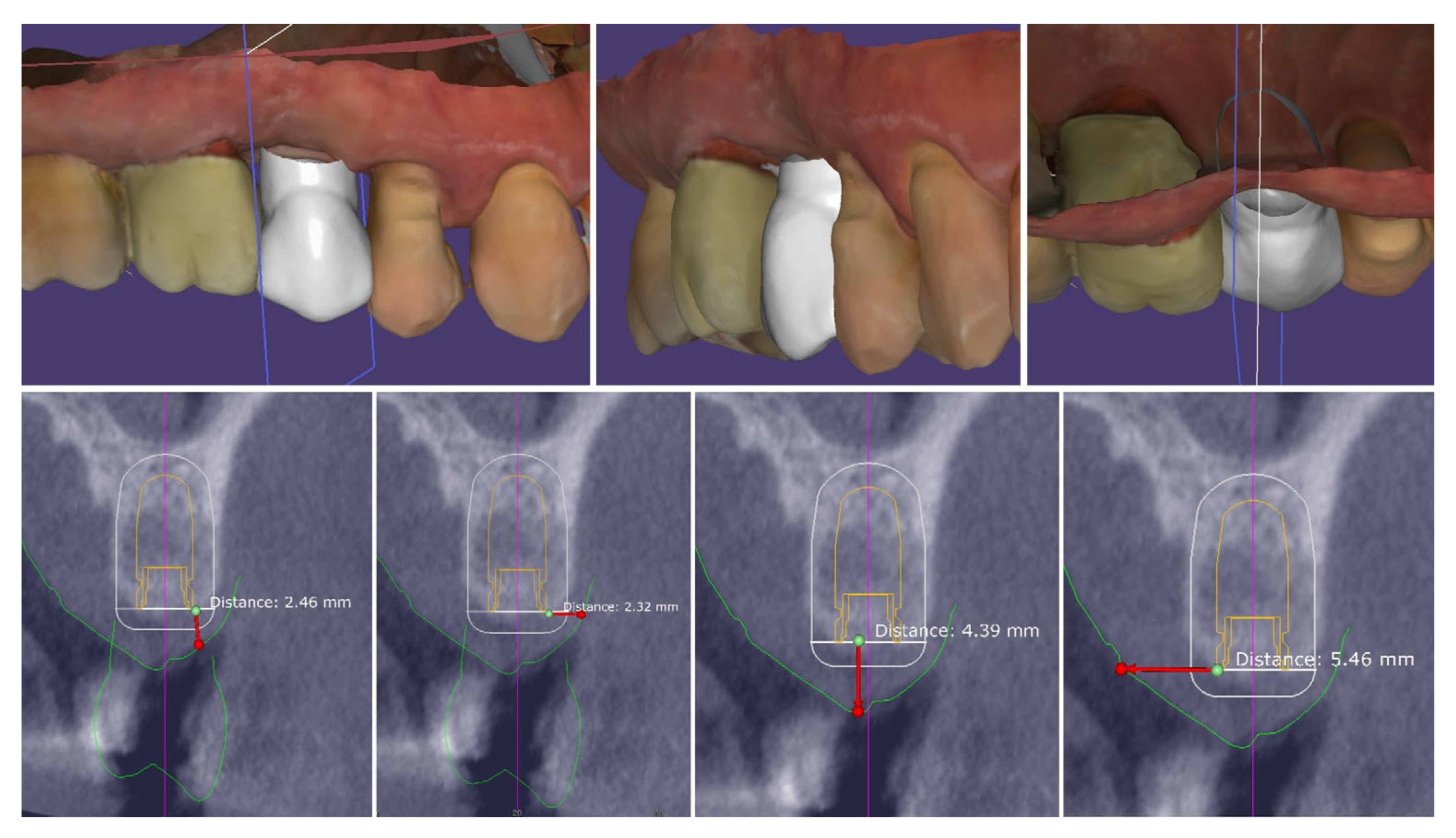Dentistry 13 00483 g006