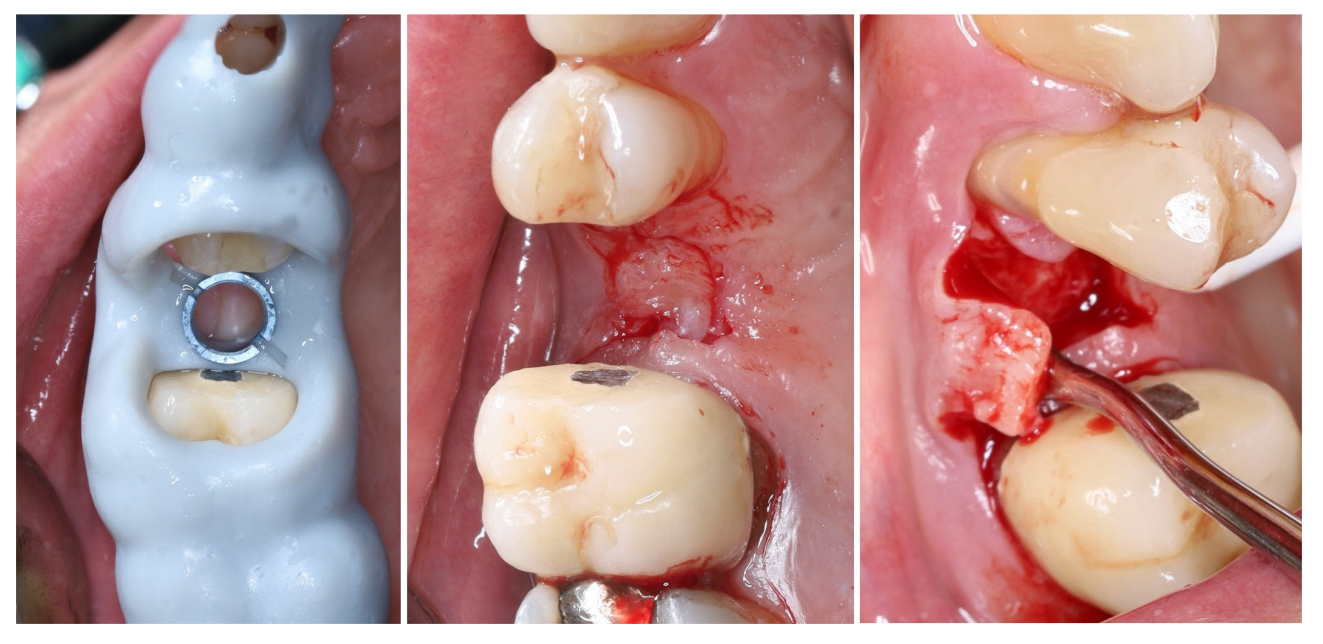 Dentistry 13 00483 g007