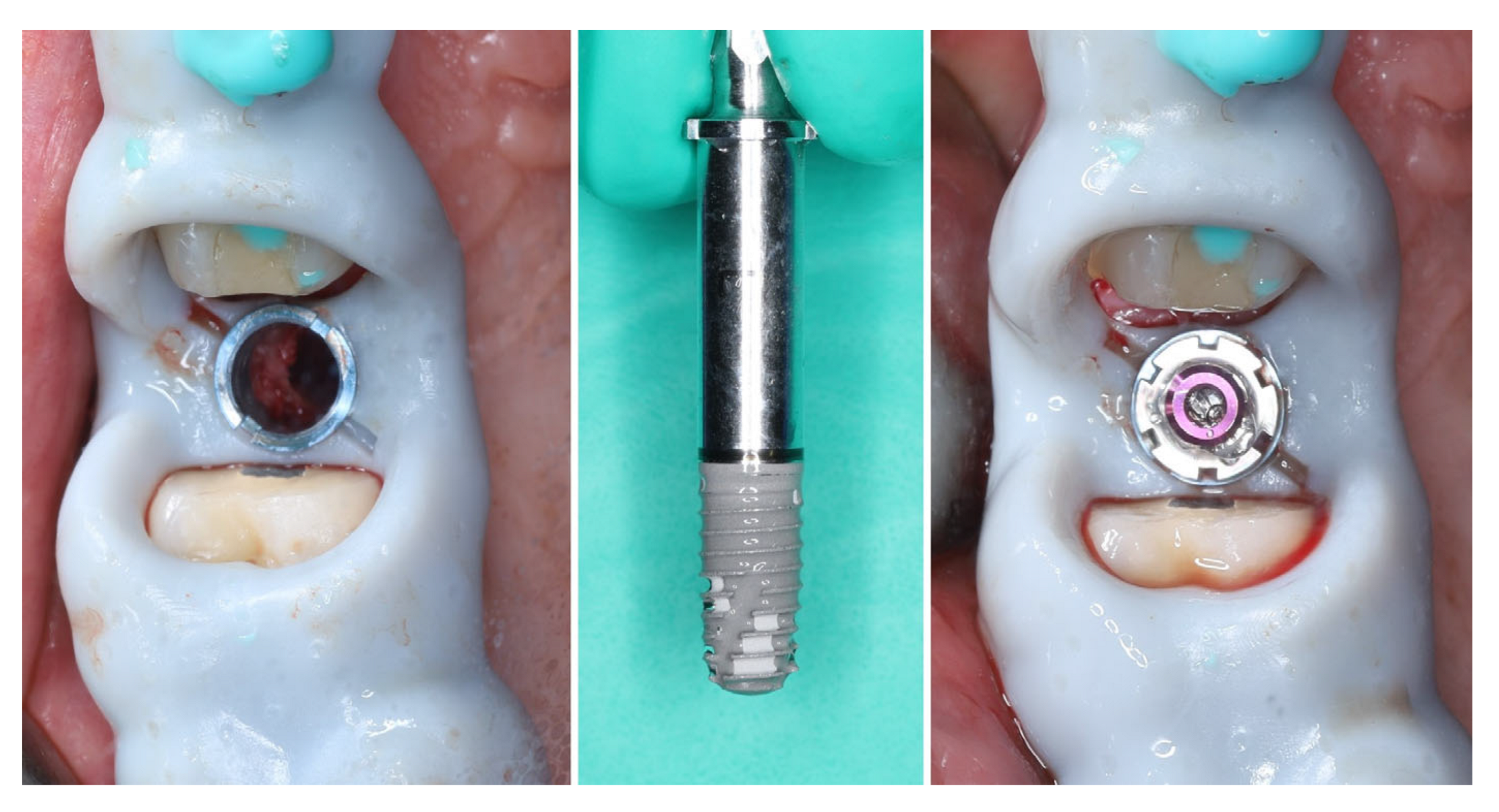 Dentistry 13 00483 g008