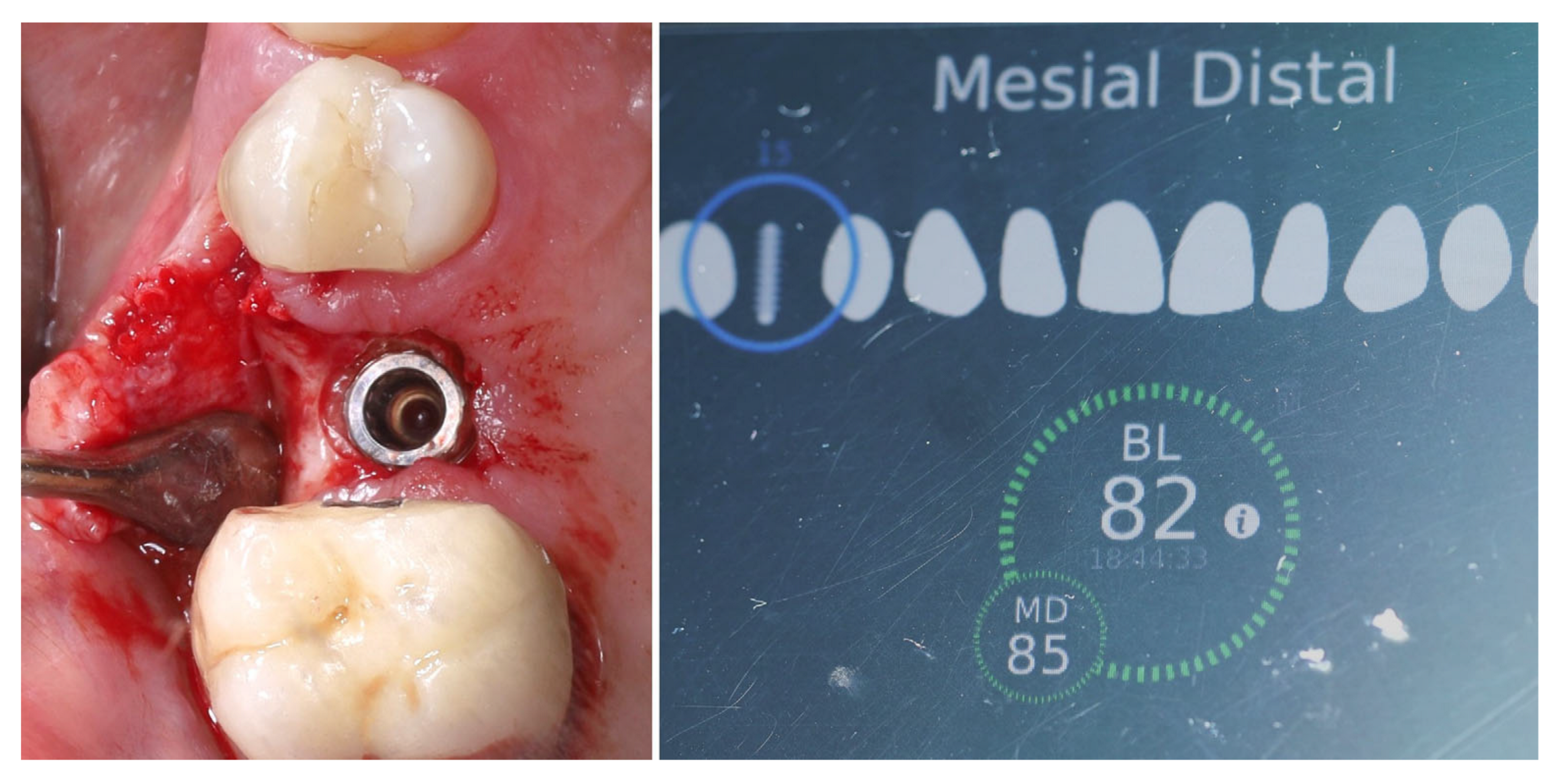 Dentistry 13 00483 g009