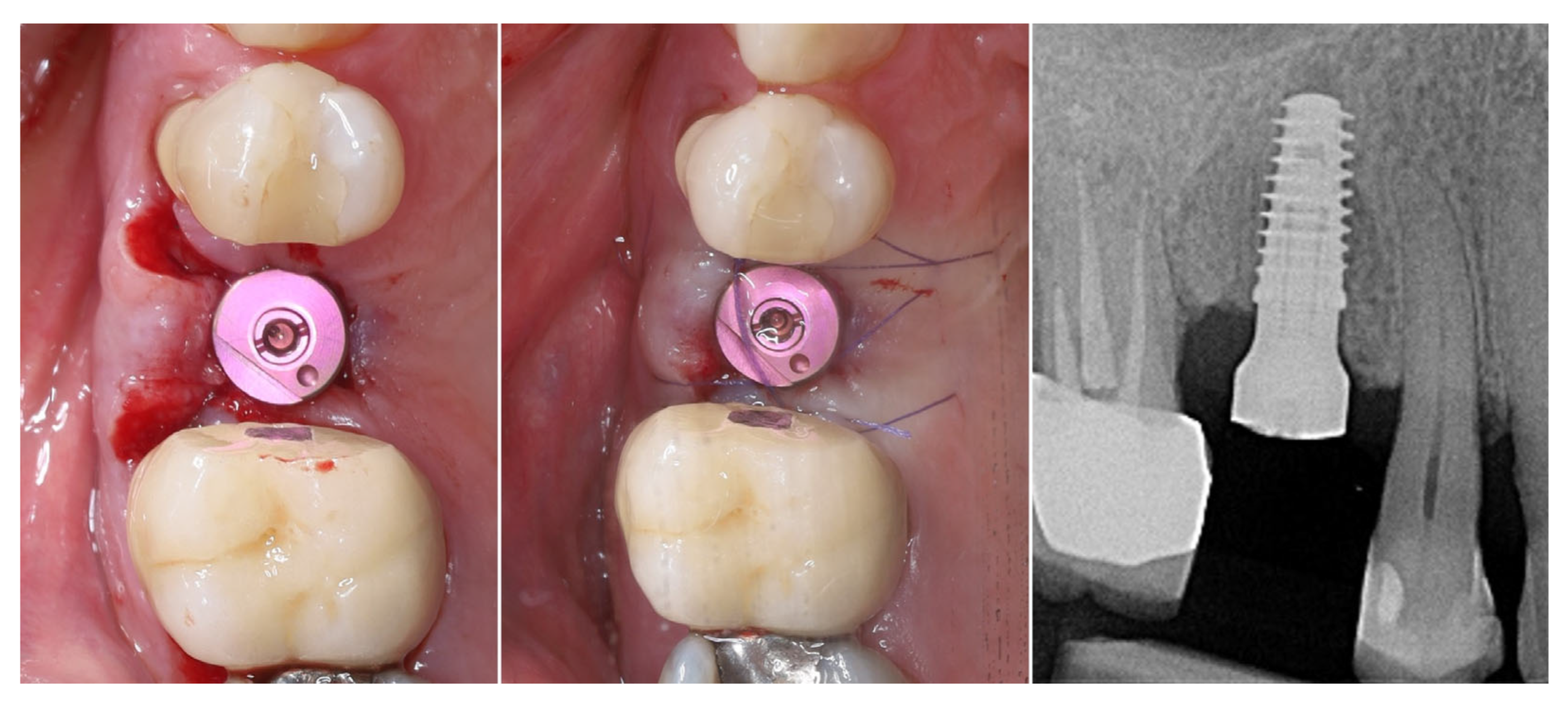 Dentistry 13 00483 g010