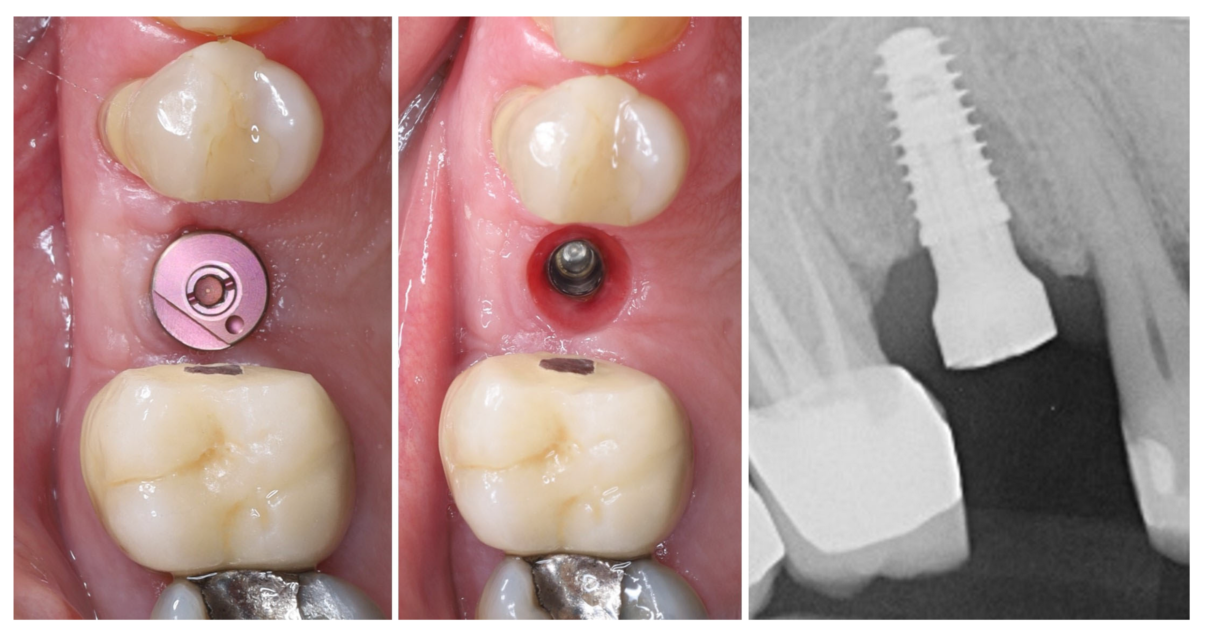 Dentistry 13 00483 g012
